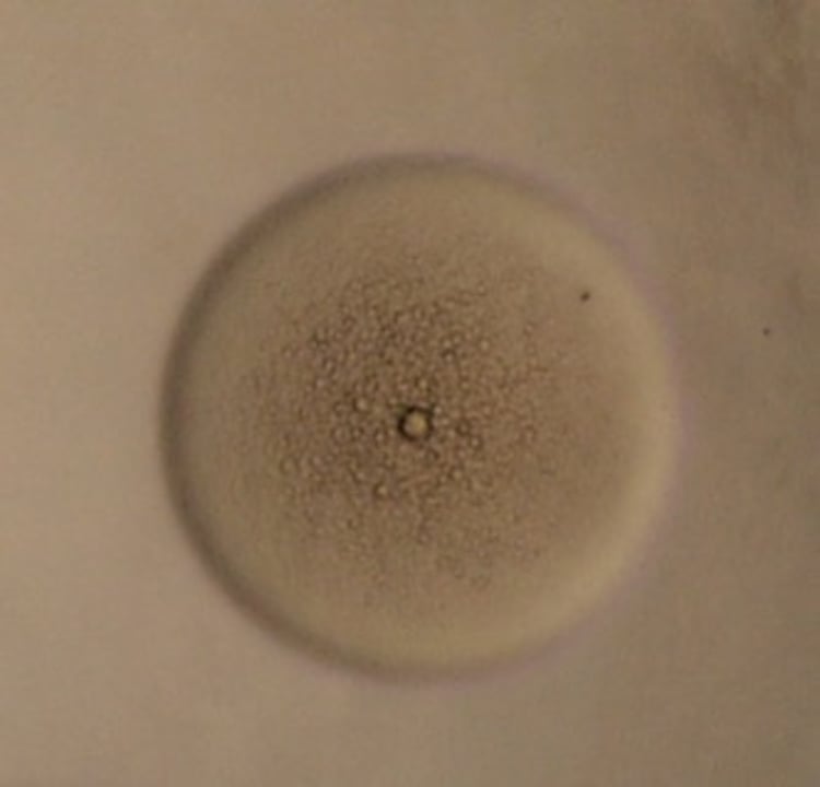 <i >Mycoplasma mycoides capri</i>, culture