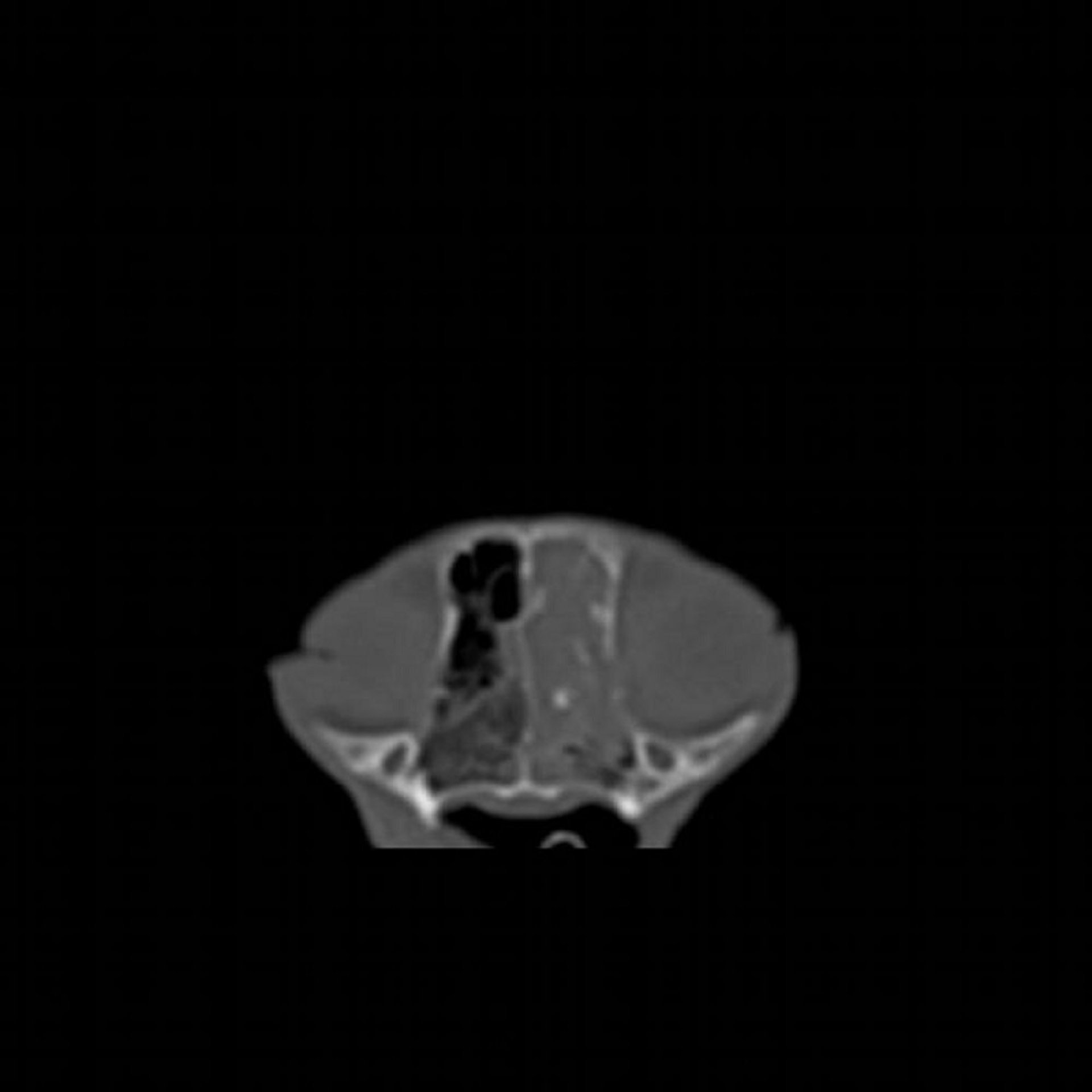 Nasal adenocarcinoma, CT, cat