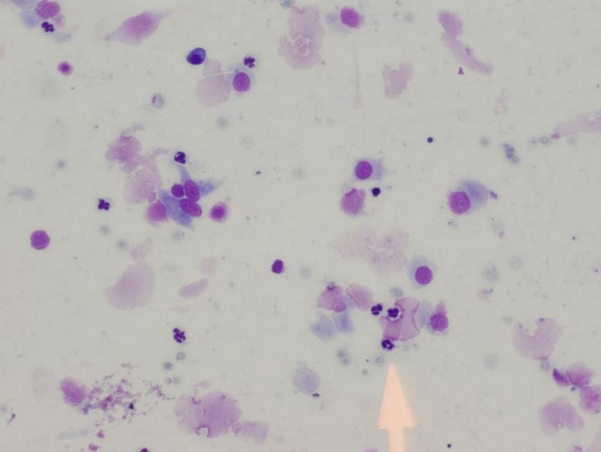 Neutrophils in uterus
