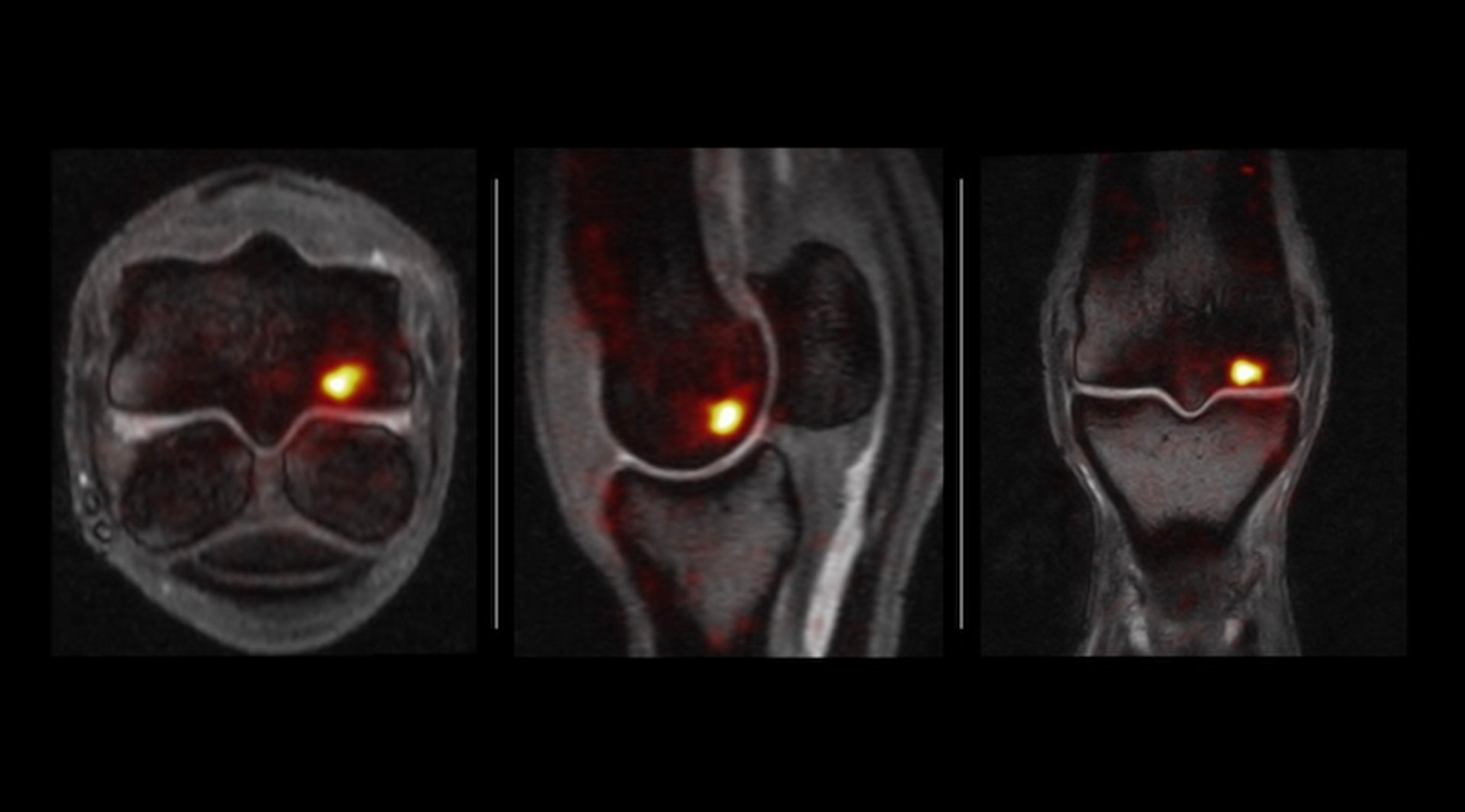 NaF PET fused with MRI, metacarpophalangeal joint, horse