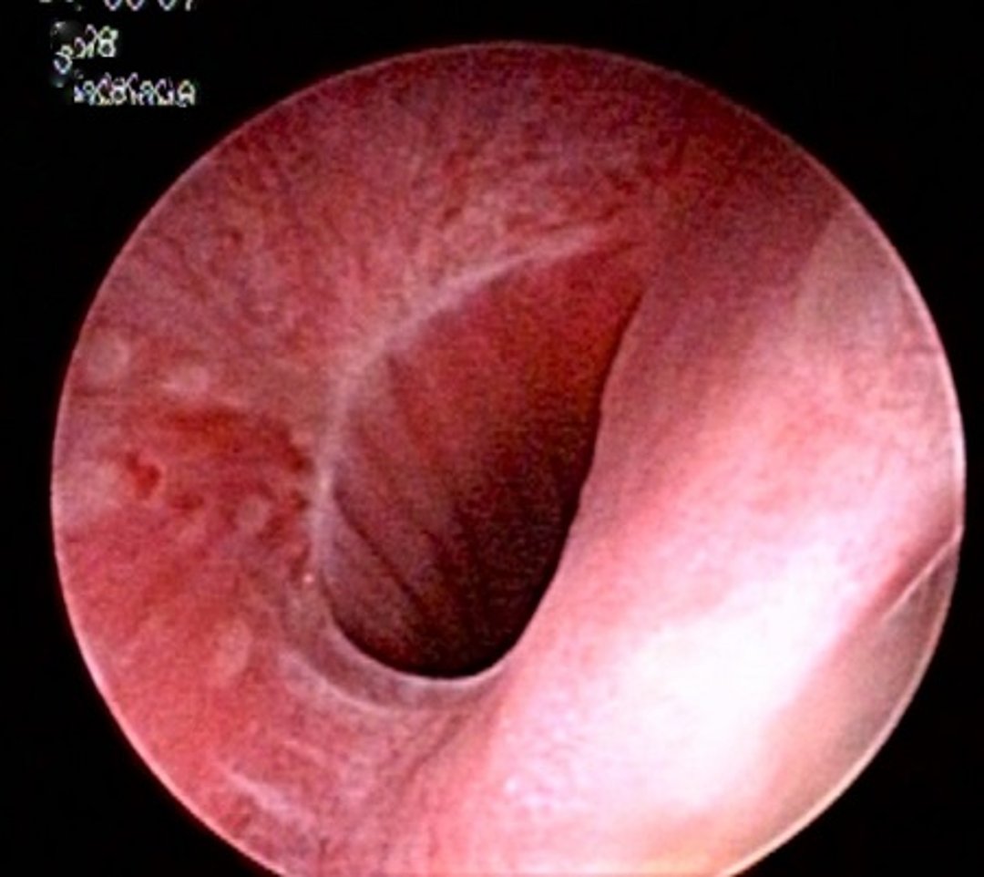 Estrechamiento de la unión vestibulovaginal, endoscopia, perra