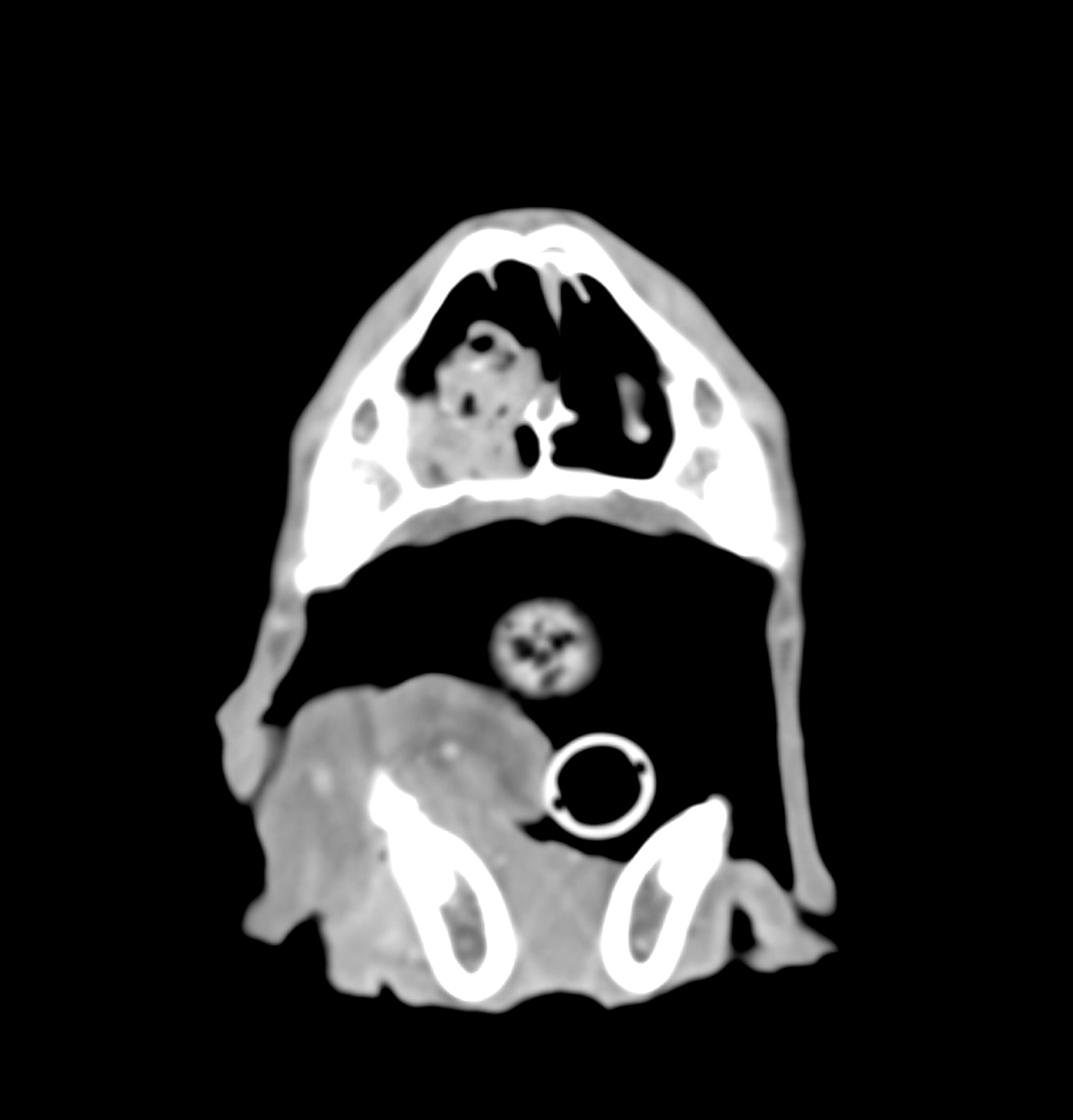 Tumor nasal antes del tratamiento, TC