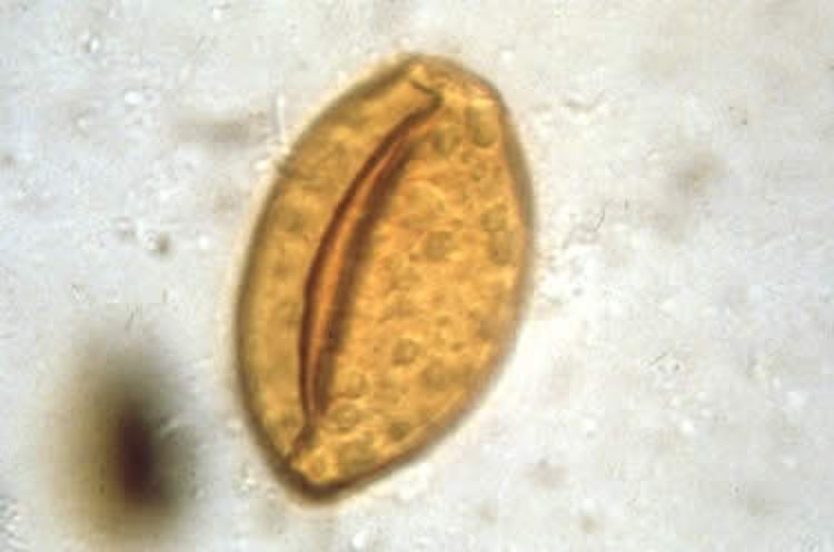 <i >Nasitrema</i> spp, huevo embrionado