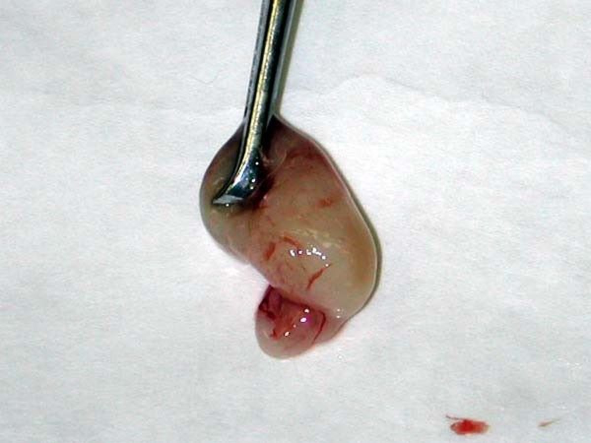 Nasopharyngeal polyp, cat