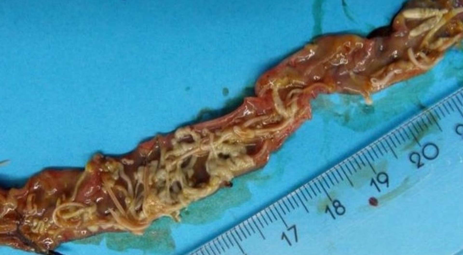 Unidentified helminths, blackbird