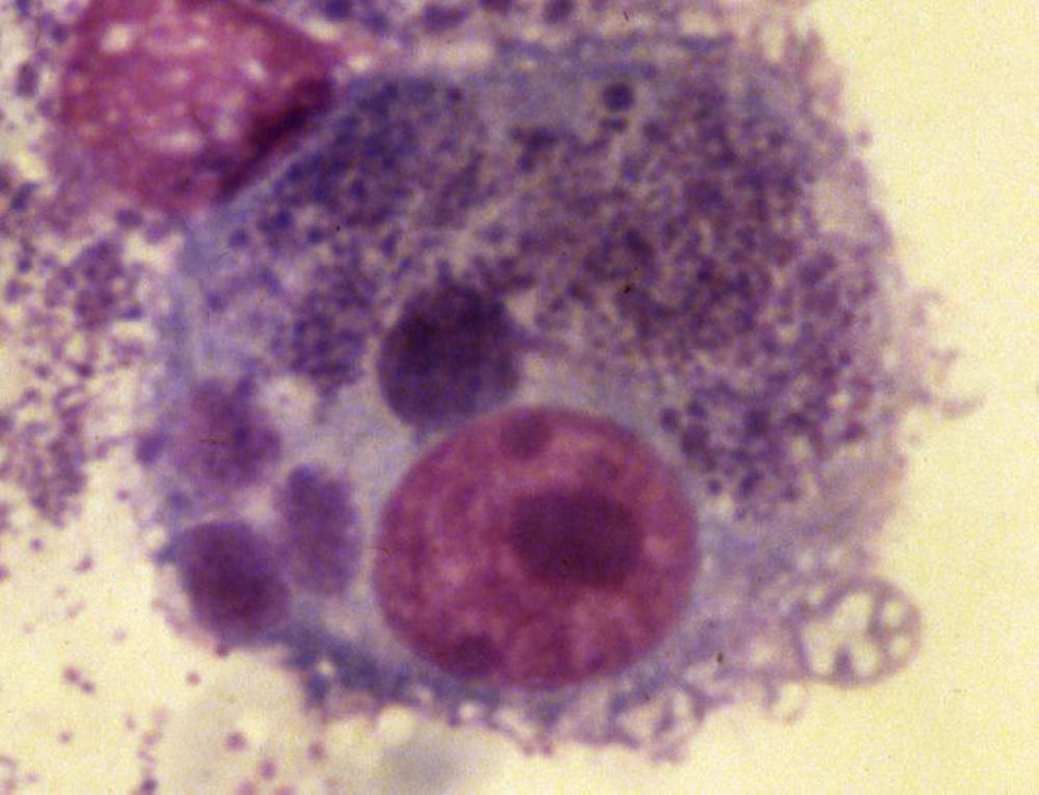 <i >Neorickettsia helminthoeca</i>, perro