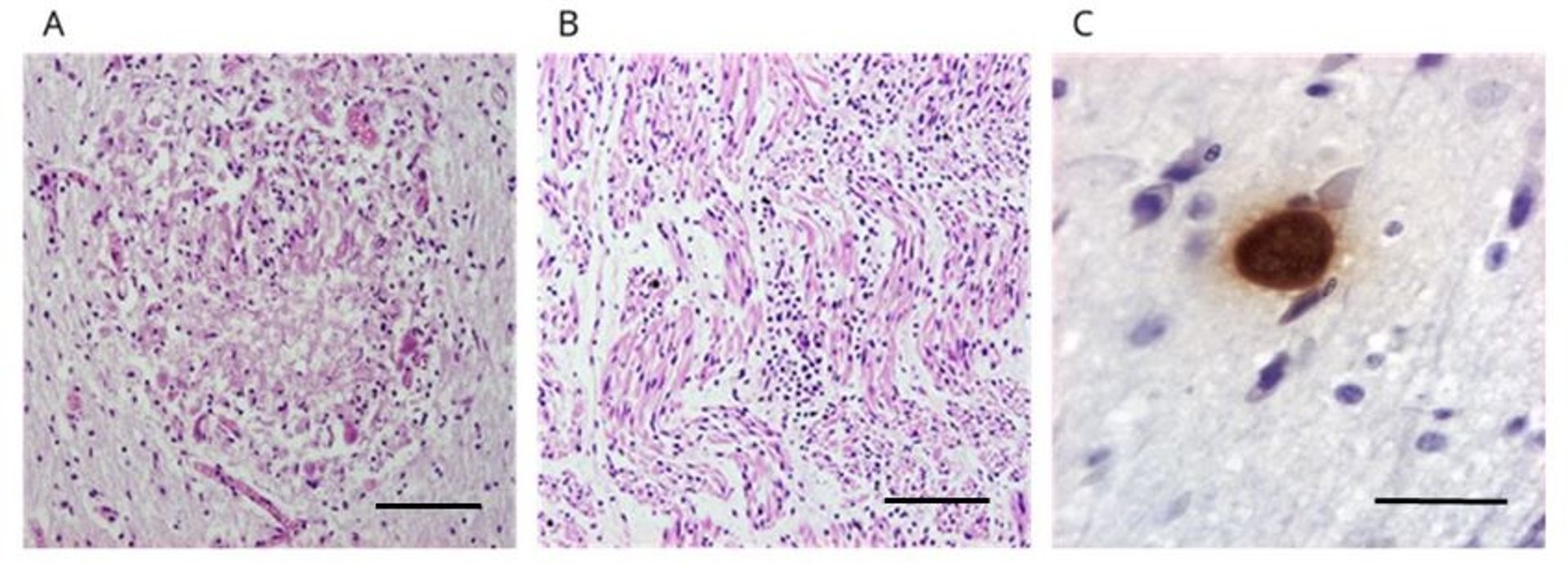 Neosporosis, histología, feto bovino