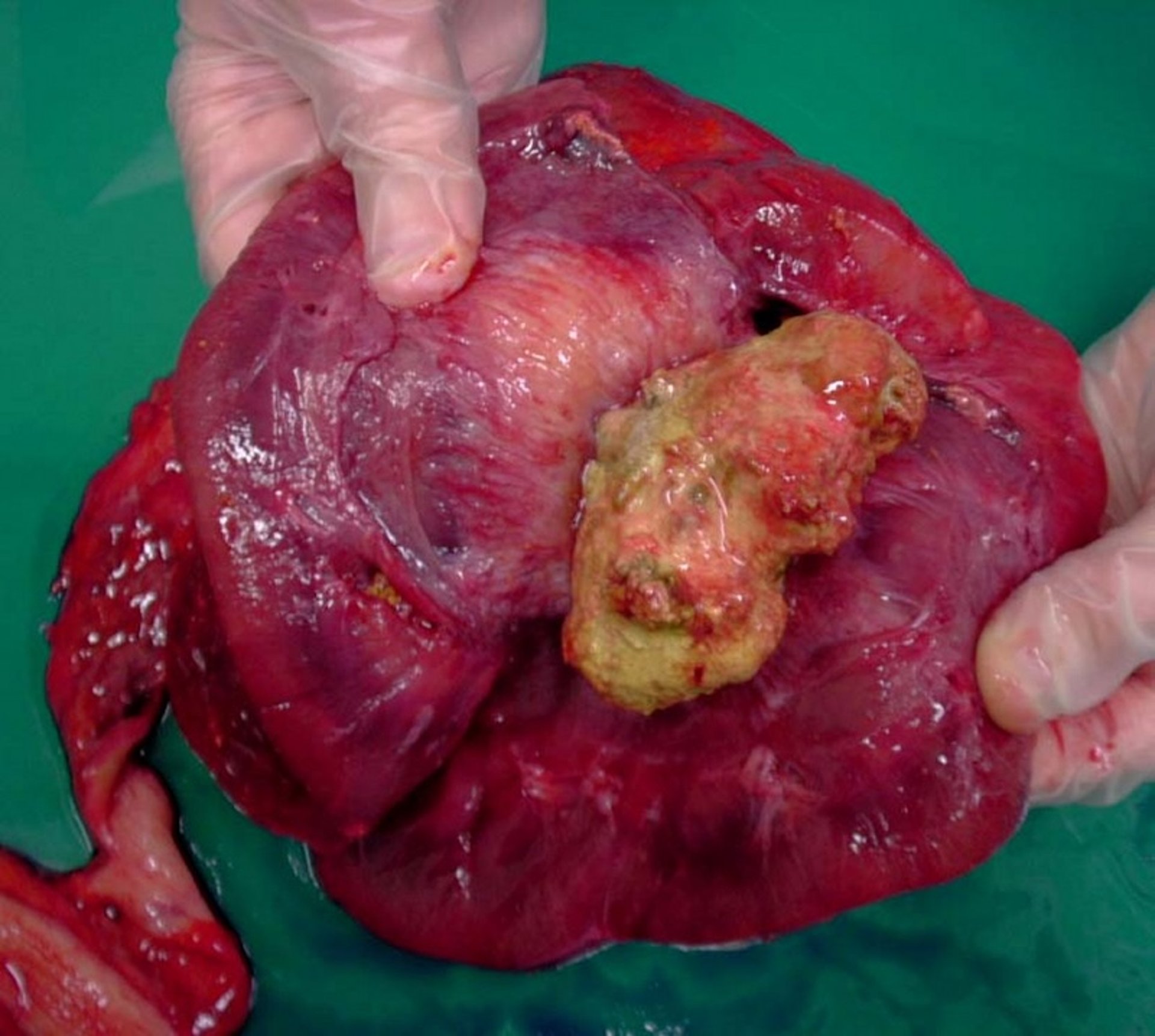 Nephrolithiasis, horse