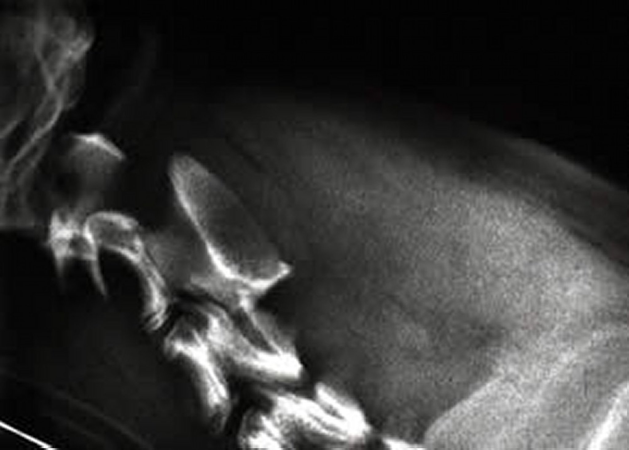 Malformación occipitoatlantoaxial, radiografía, perro