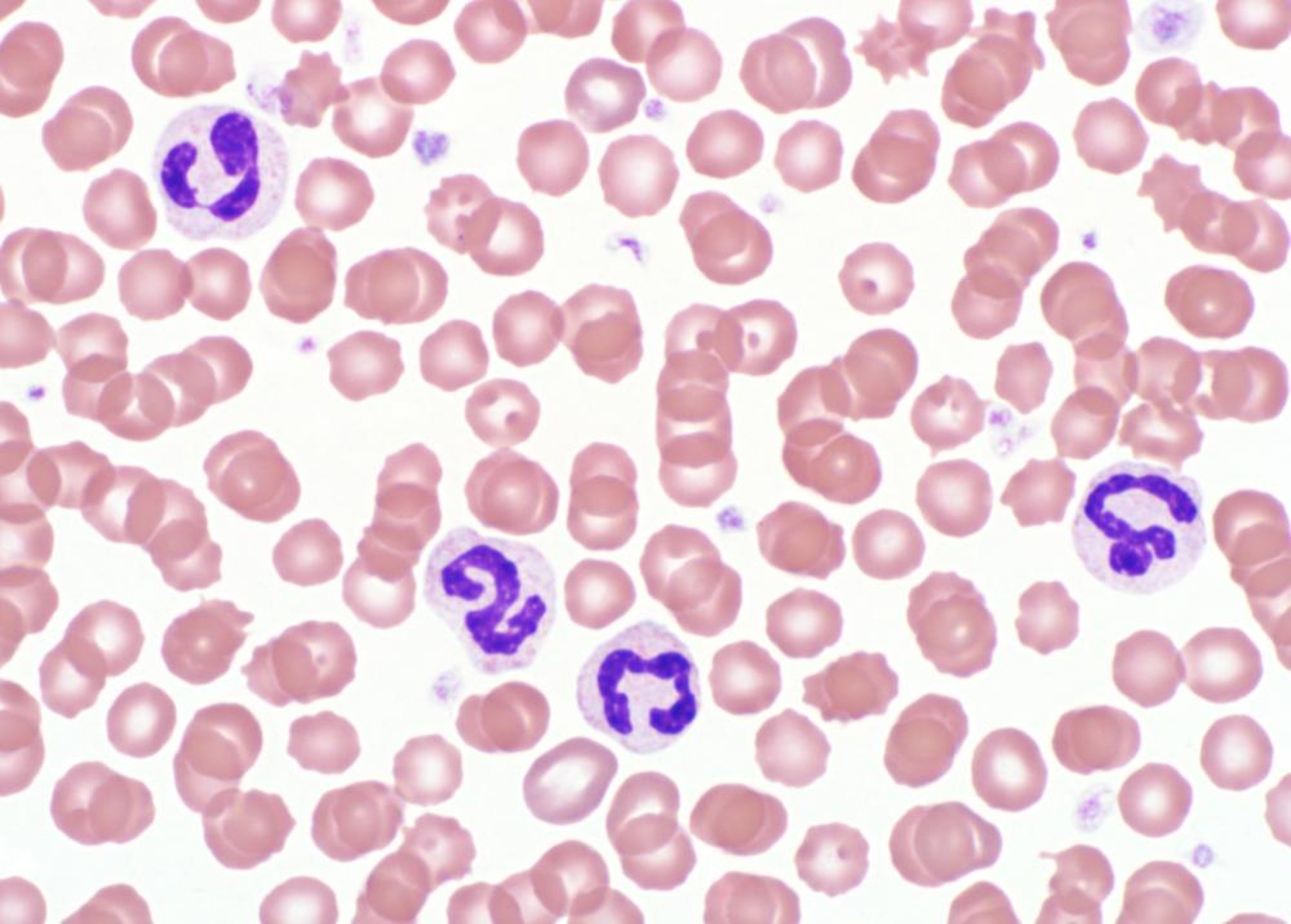 Neutrofilia, esfregaço de sangue, cão