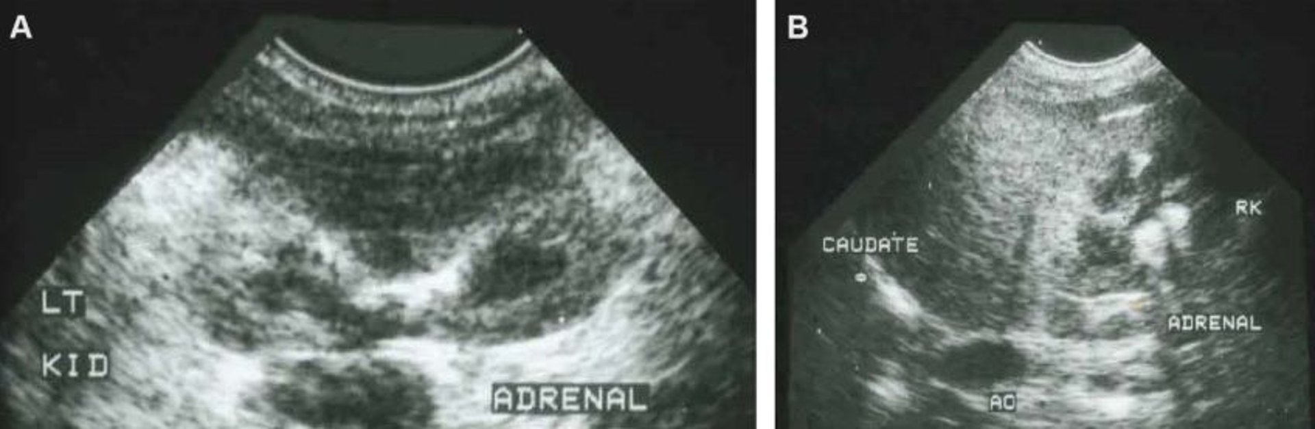Normal adrenal glands, ultrasonograms, dog