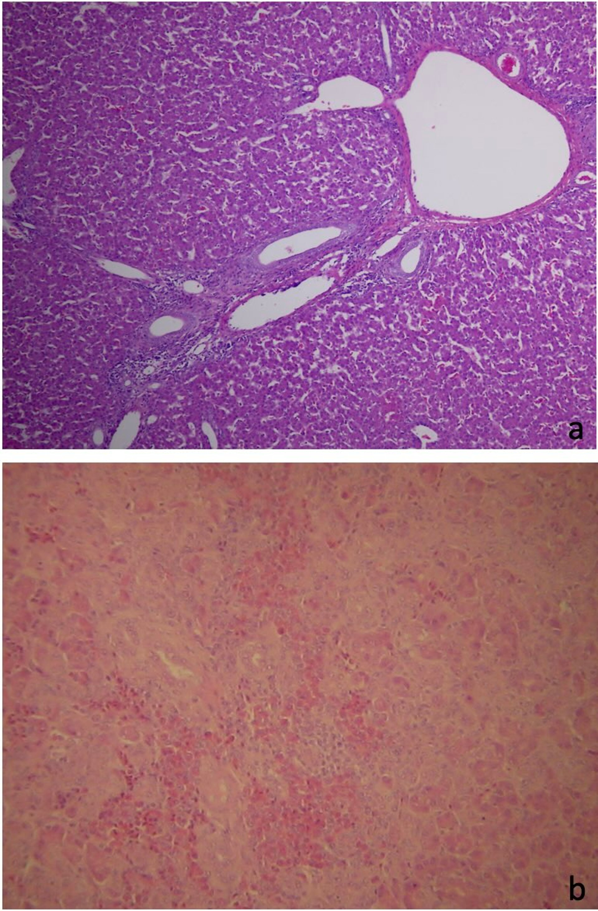 Normal and affected chicken livers