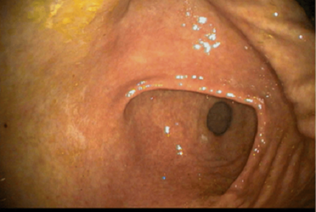 Mucosa glandular normal, estómago, caballo adulto