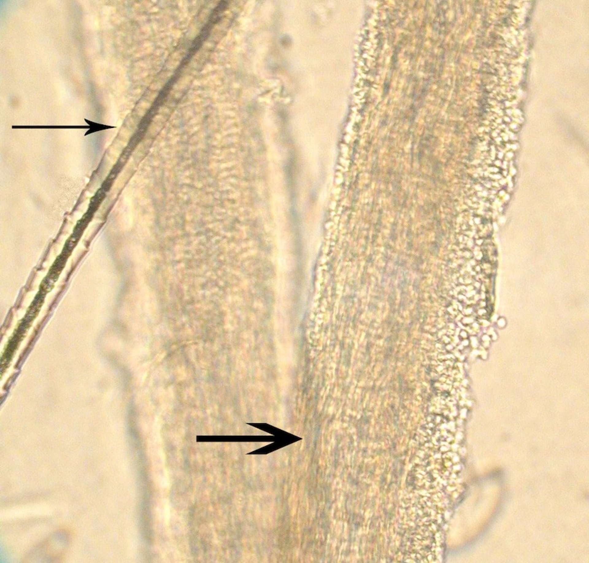 Pelo normal y pelo infectado por <i >Microsporum canis</i>