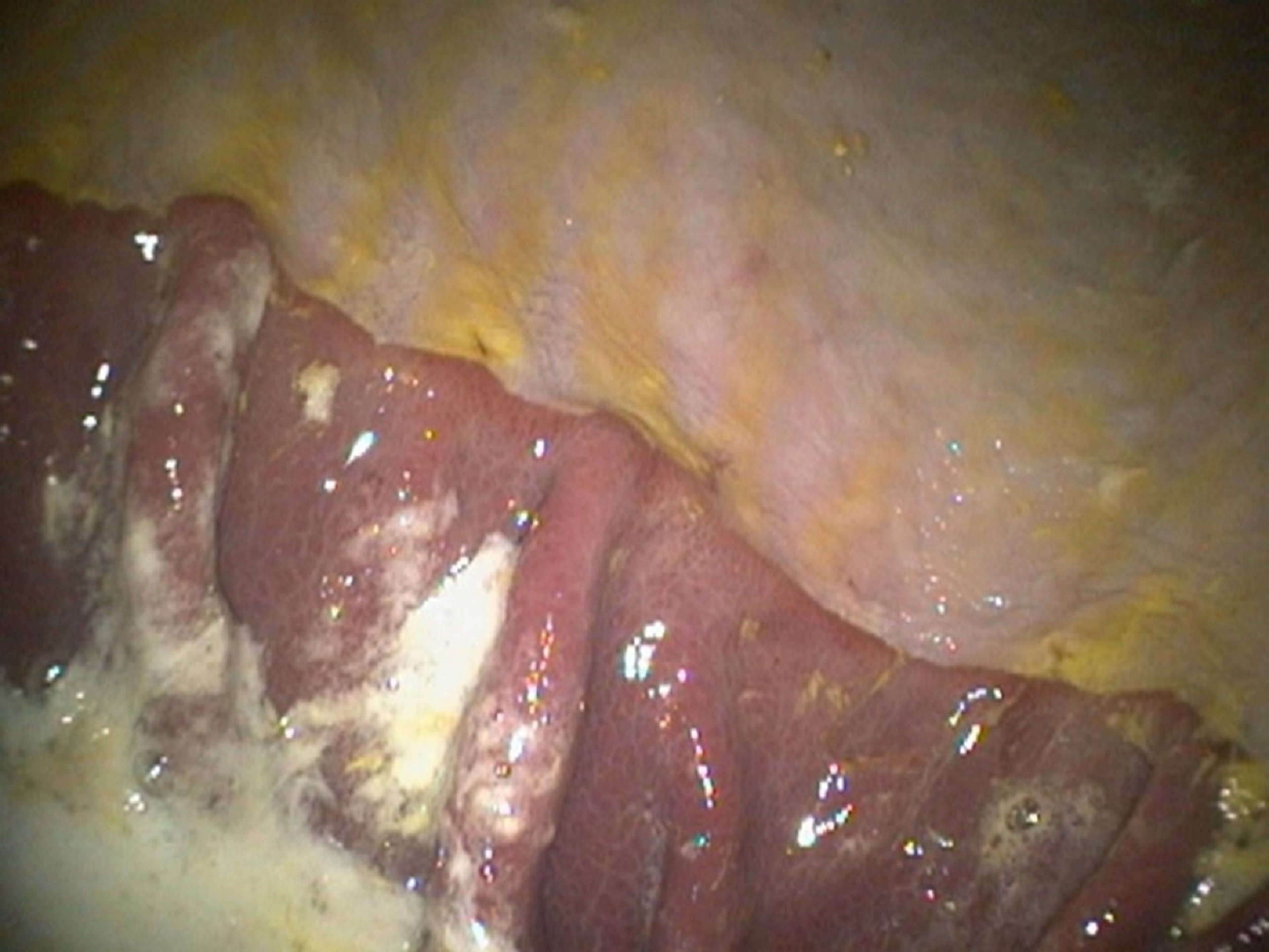Mucosa normal, estômago, cavalo adulto