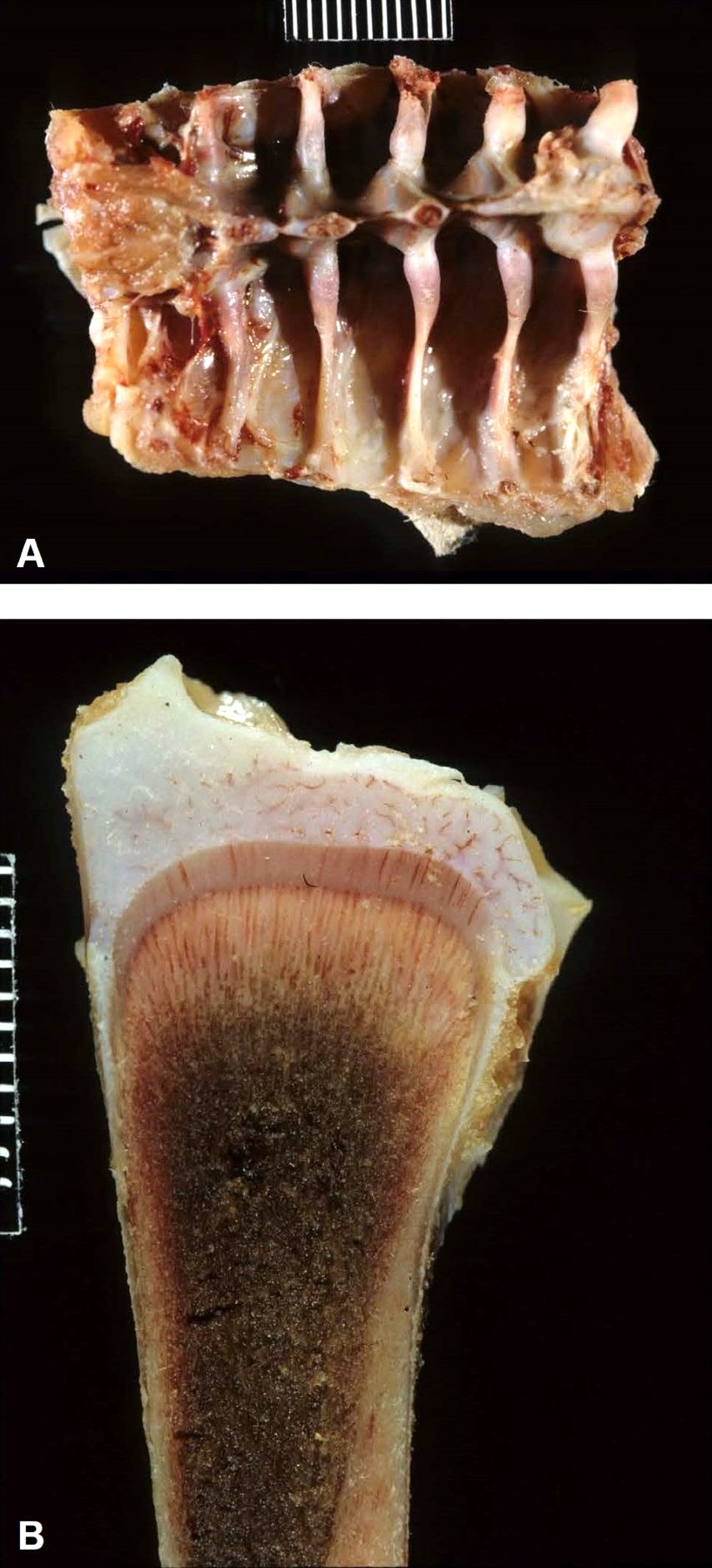 Normal ribs and tibial growth plate, broilers