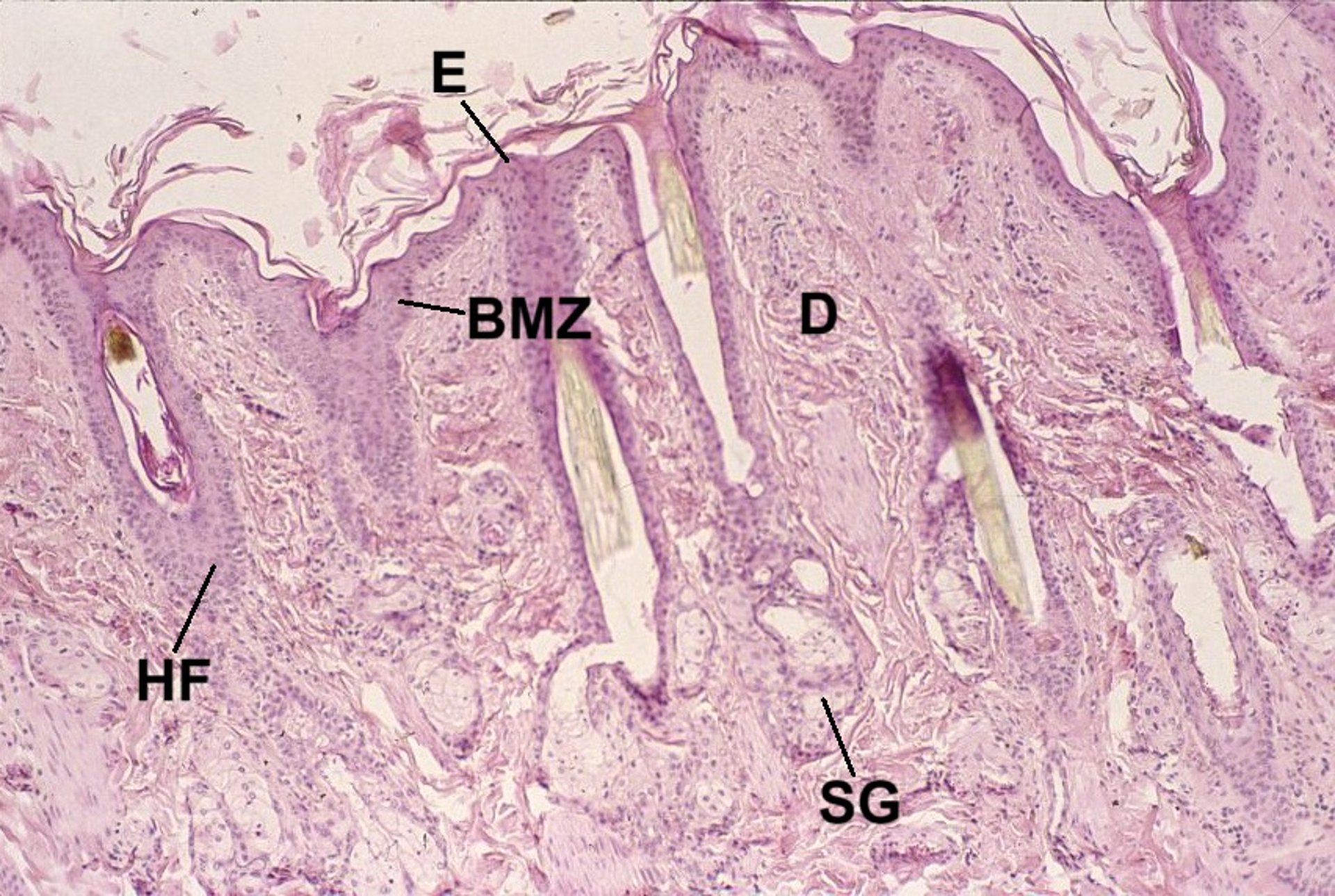 Normal skin, photomicrograph