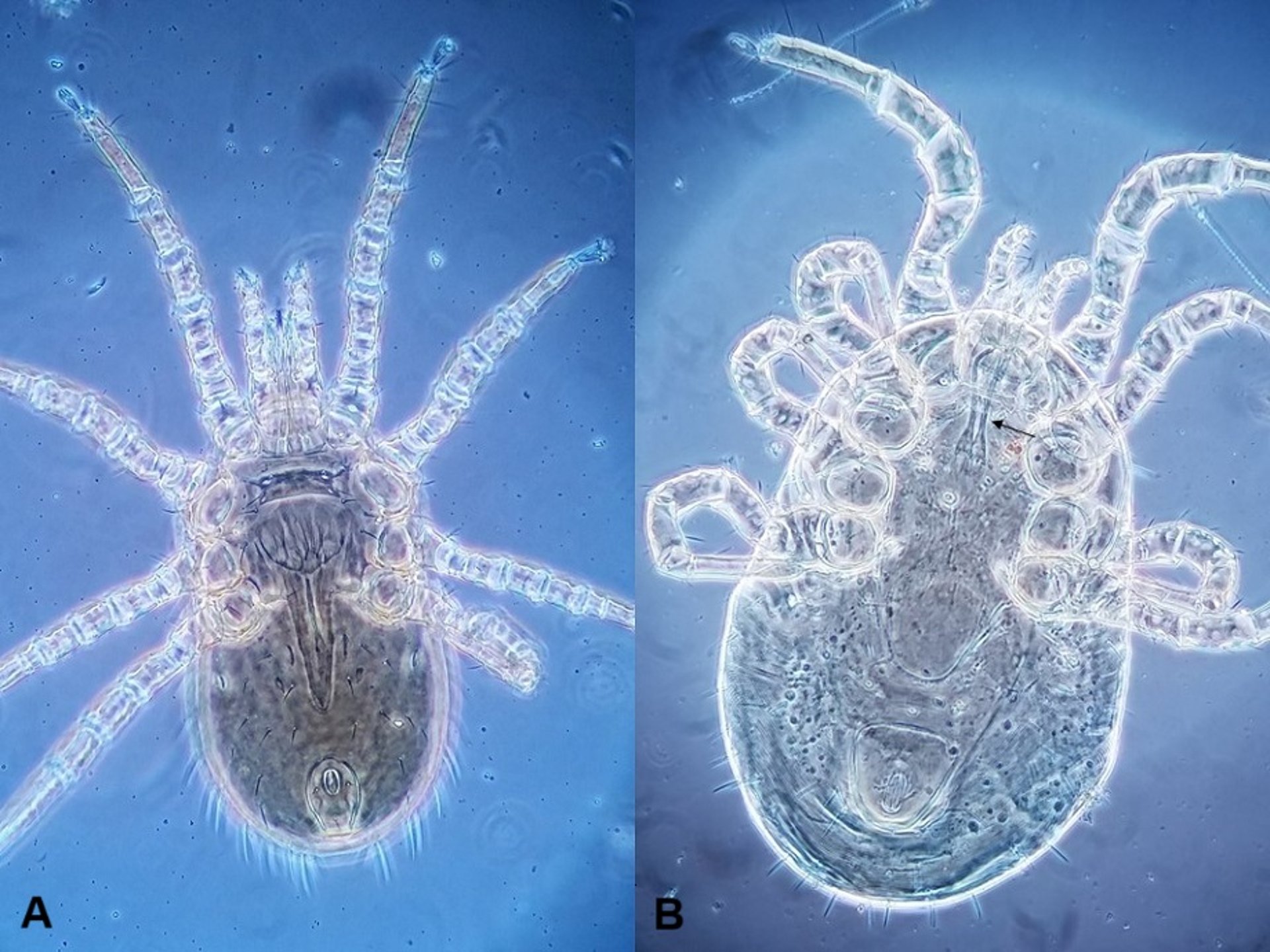 Northern fowl mite and poultry red mite, photomicrographs