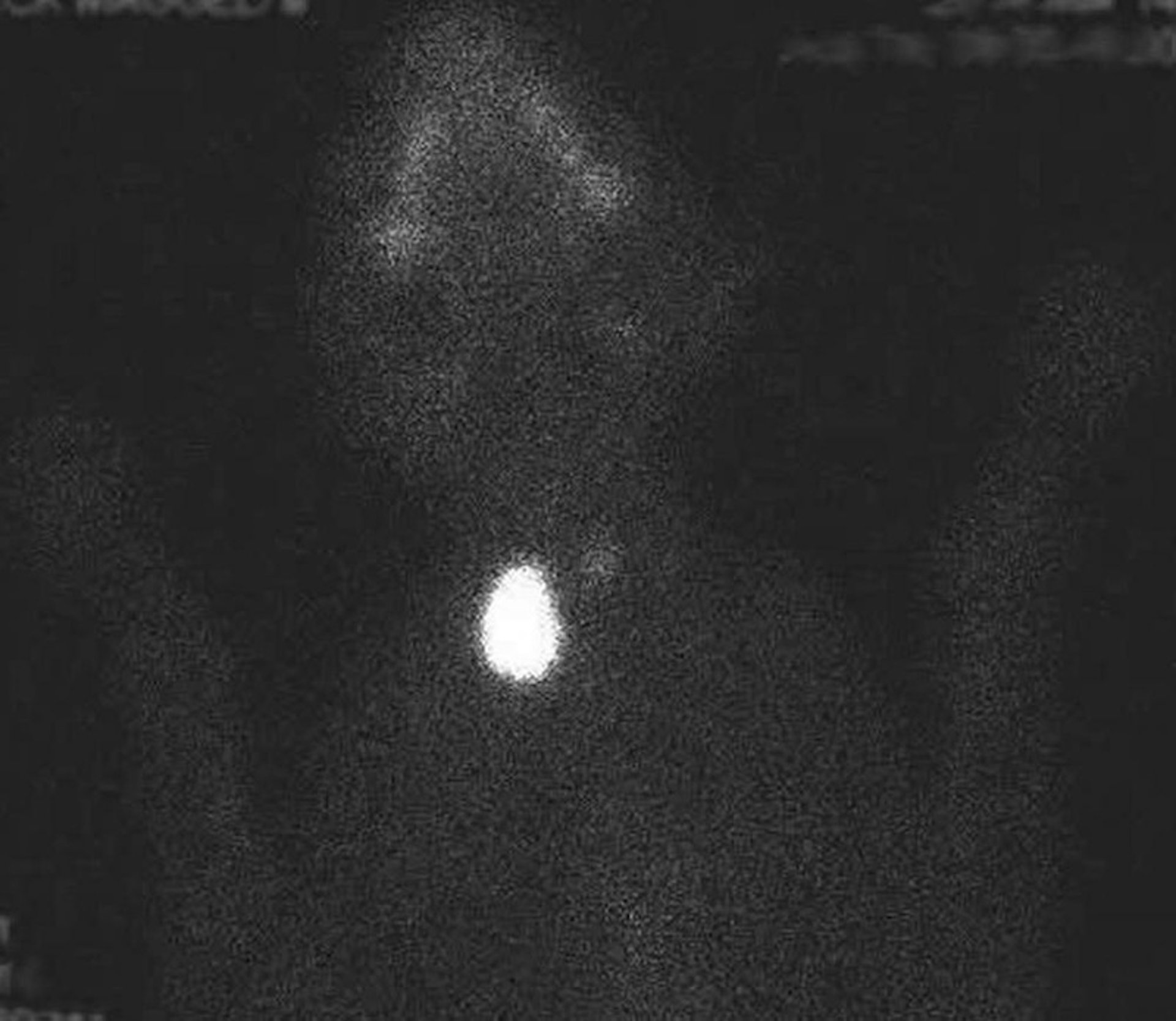 Adenoma tiroideo, exploración por medicina nuclear, gato
