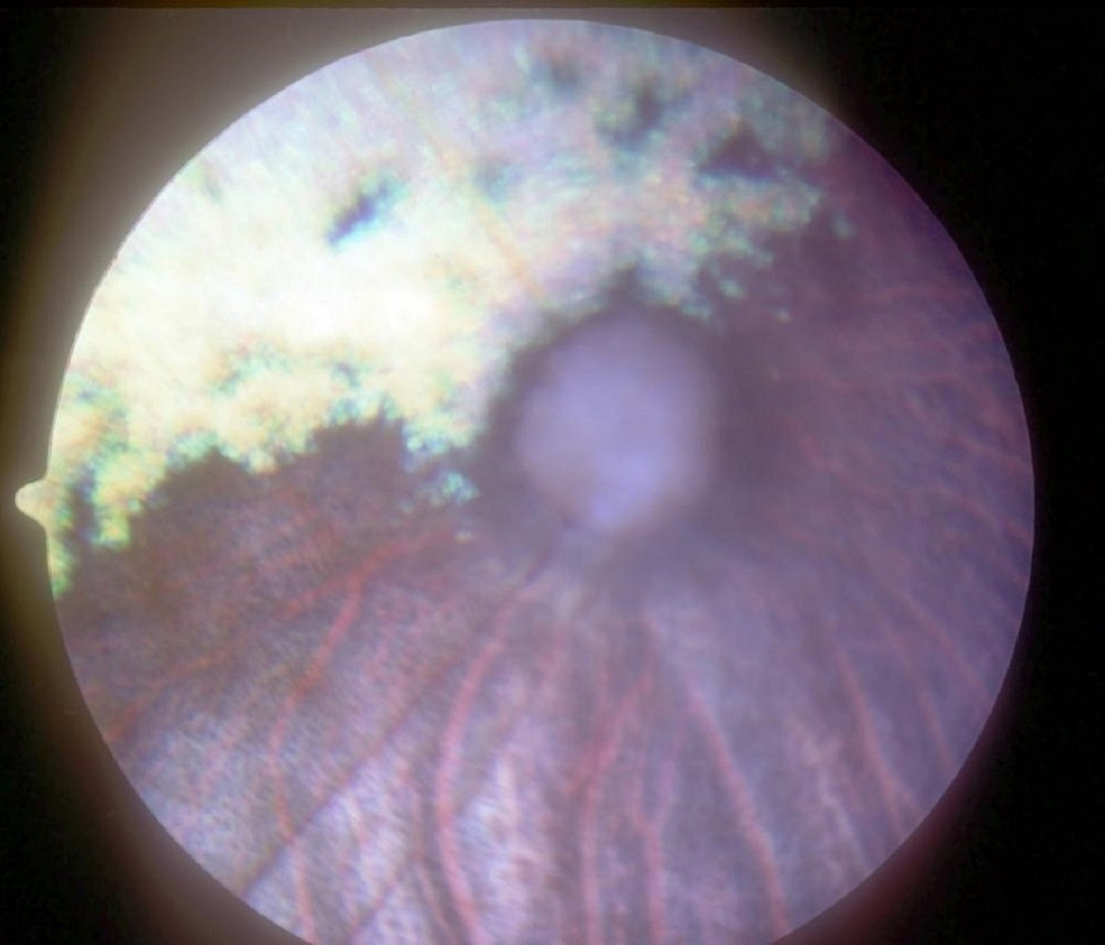 Optic nerve and retinal atrophy, dog