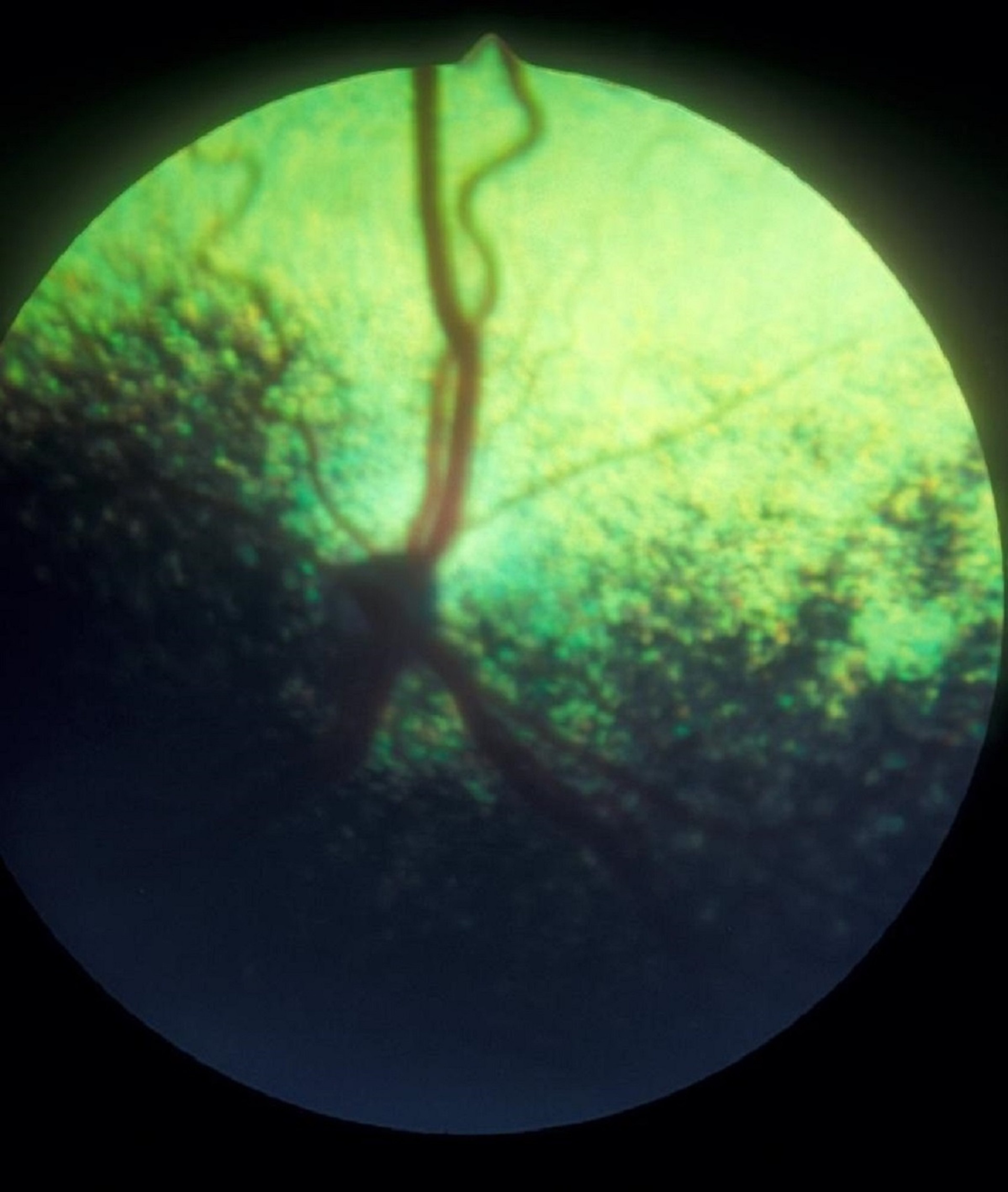 Optic nerve hypoplasia, dog