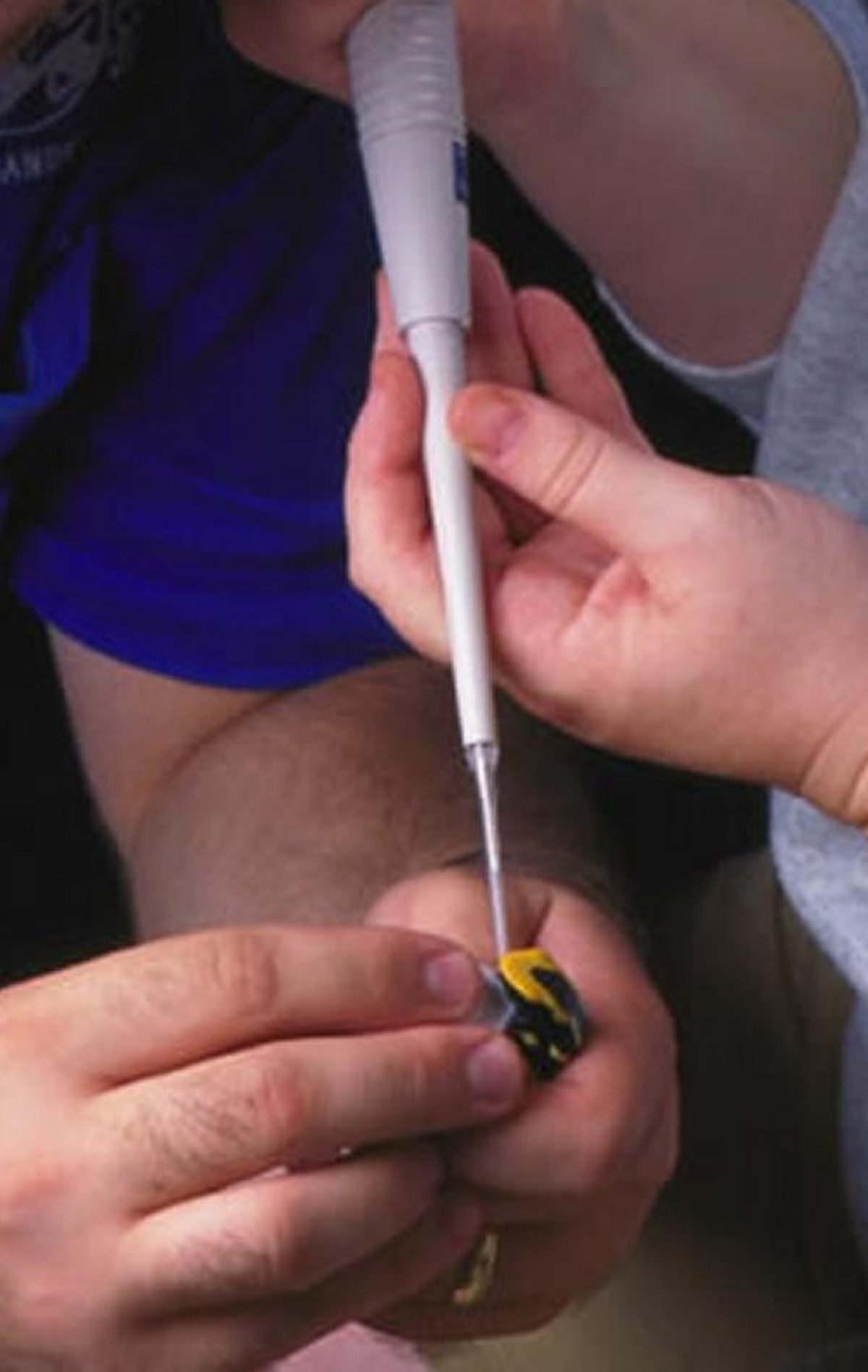 Oral administration of drug using a microliter syringe, amphibian