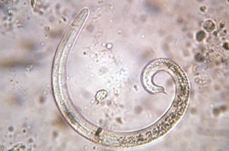 <i >Otostrongylus circumlitus</i> larva