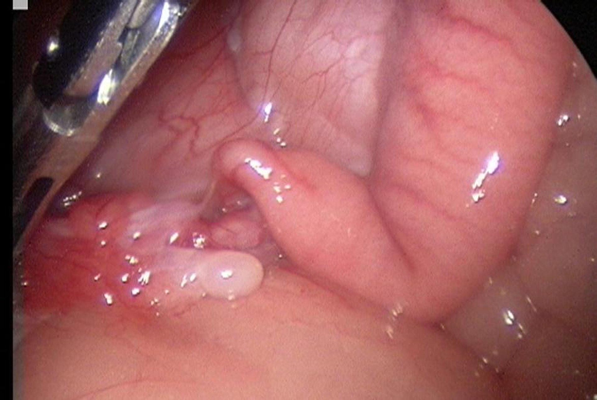 Ovarian hypoplasia, alpaca