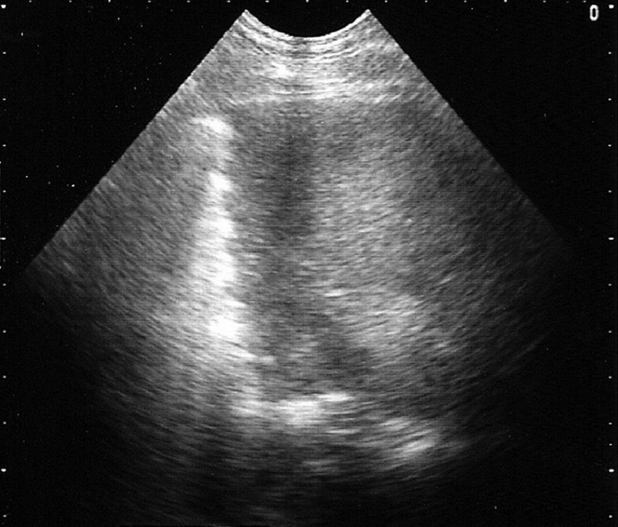 Ovine pulmonary adenocarcinoma, ultrasonography