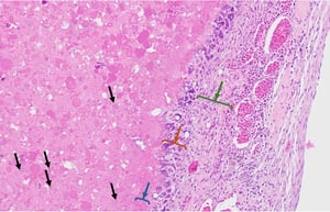 Omphalitis, photomicrograph, poultry