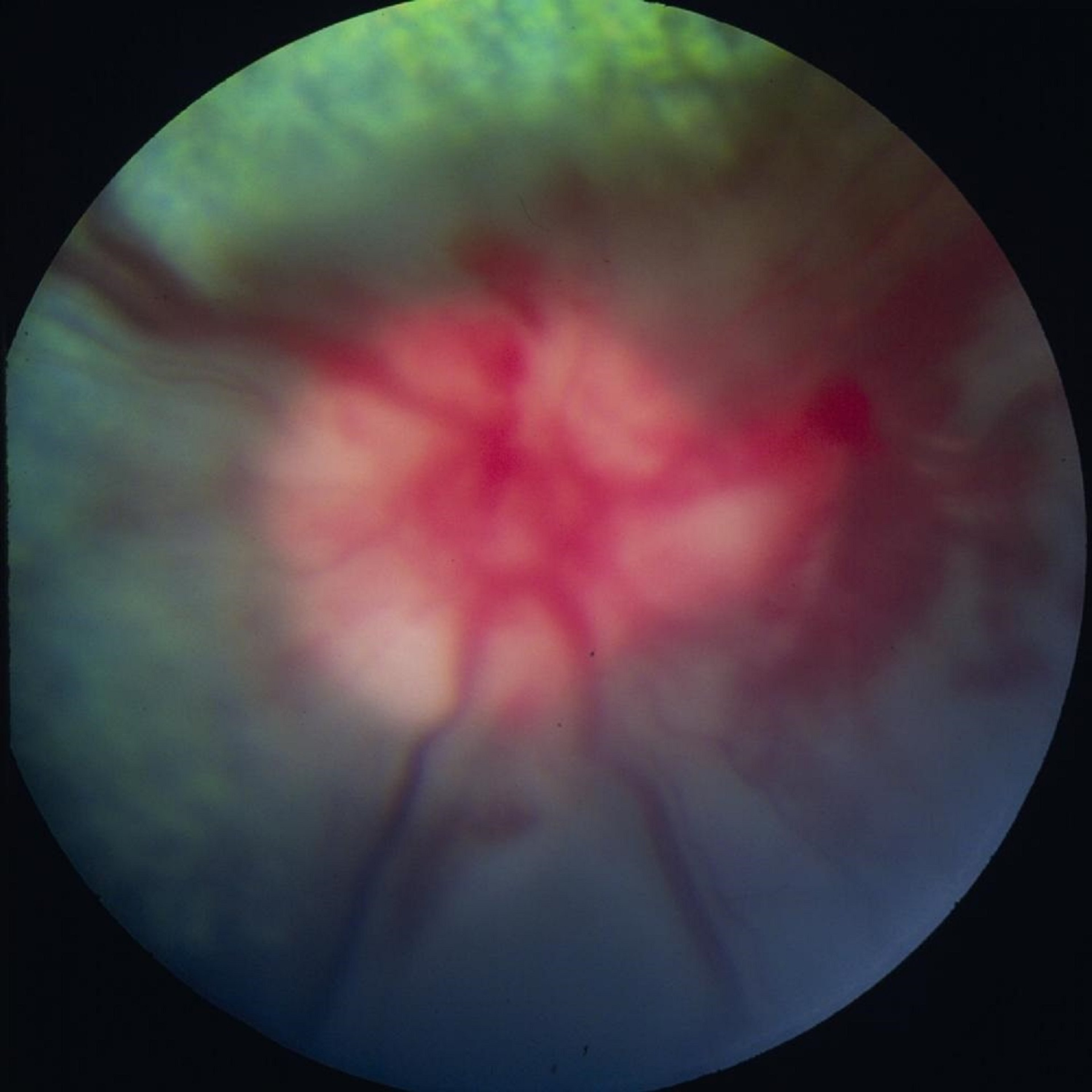Neuritis óptica secundaria a meningoencefalitis, perro