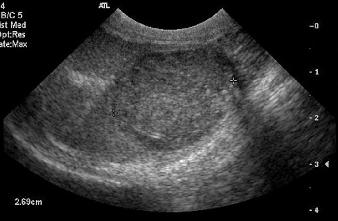 Orchitis, testicular abscess, ultrasonogram, dog