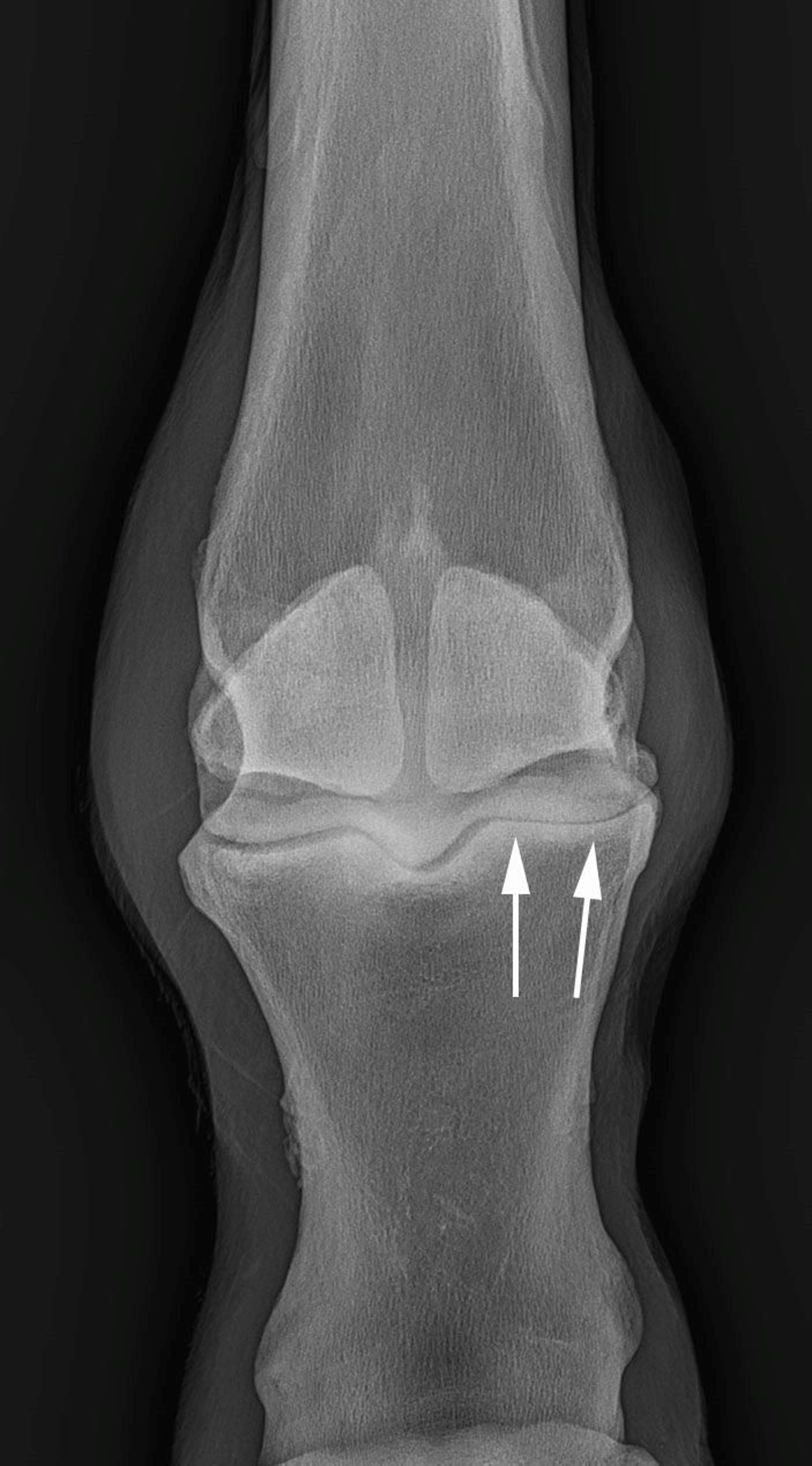Osteoarthritis, metacarpophalangeal joint, radiograph, horse