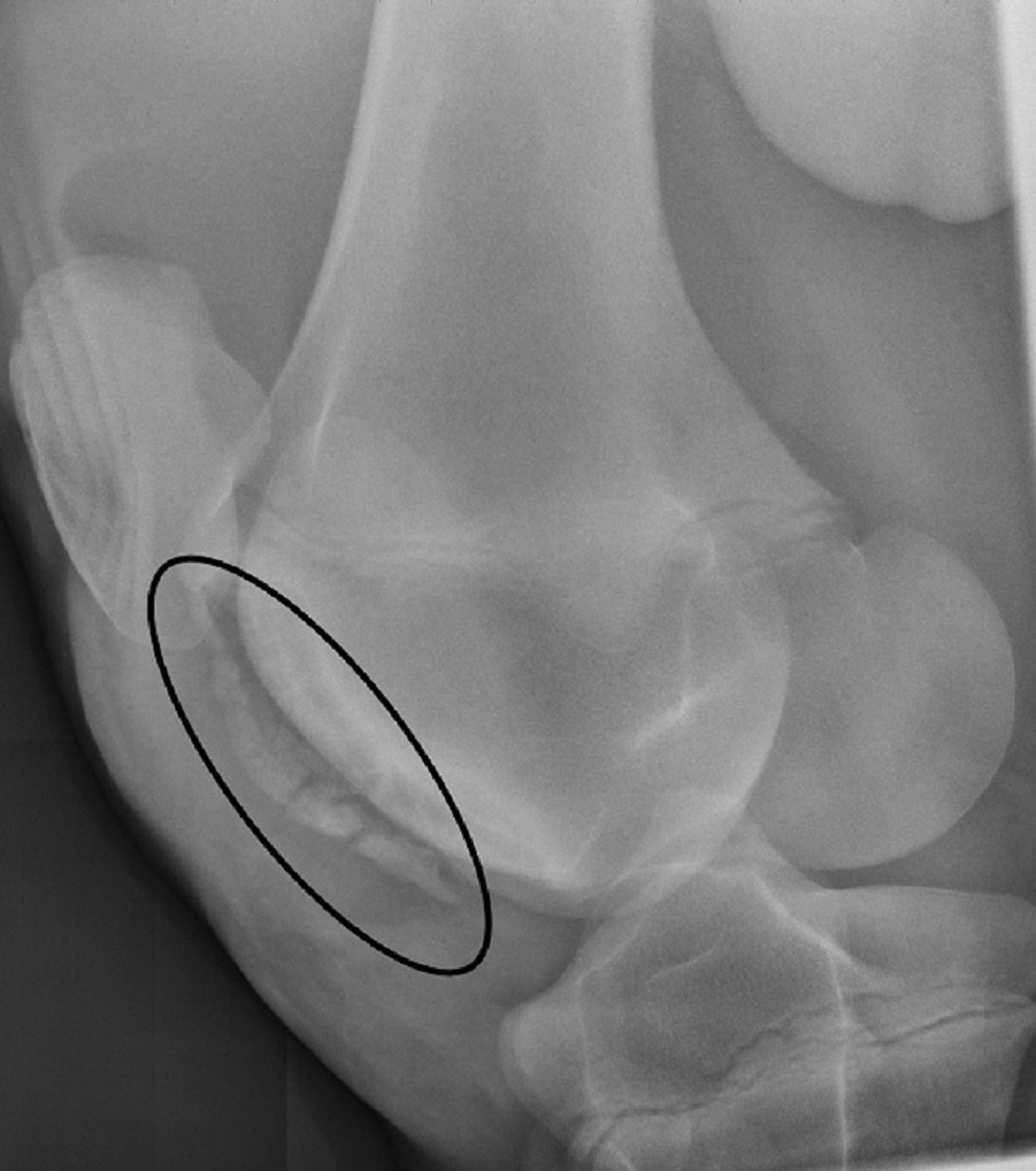 Osteocondritis disecante, articulación femororrotuliana, caballo