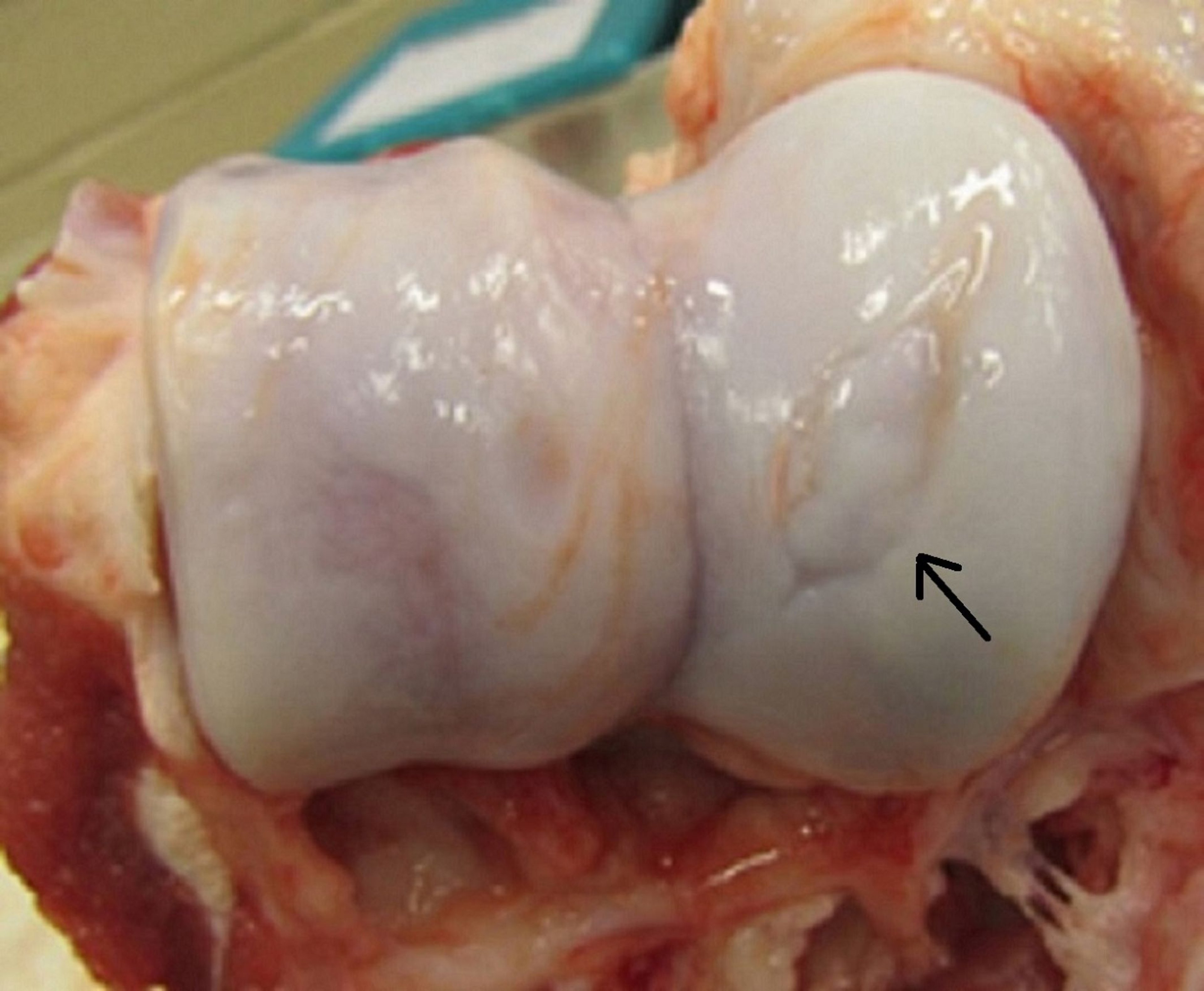 Osteocondrosis, cerdo