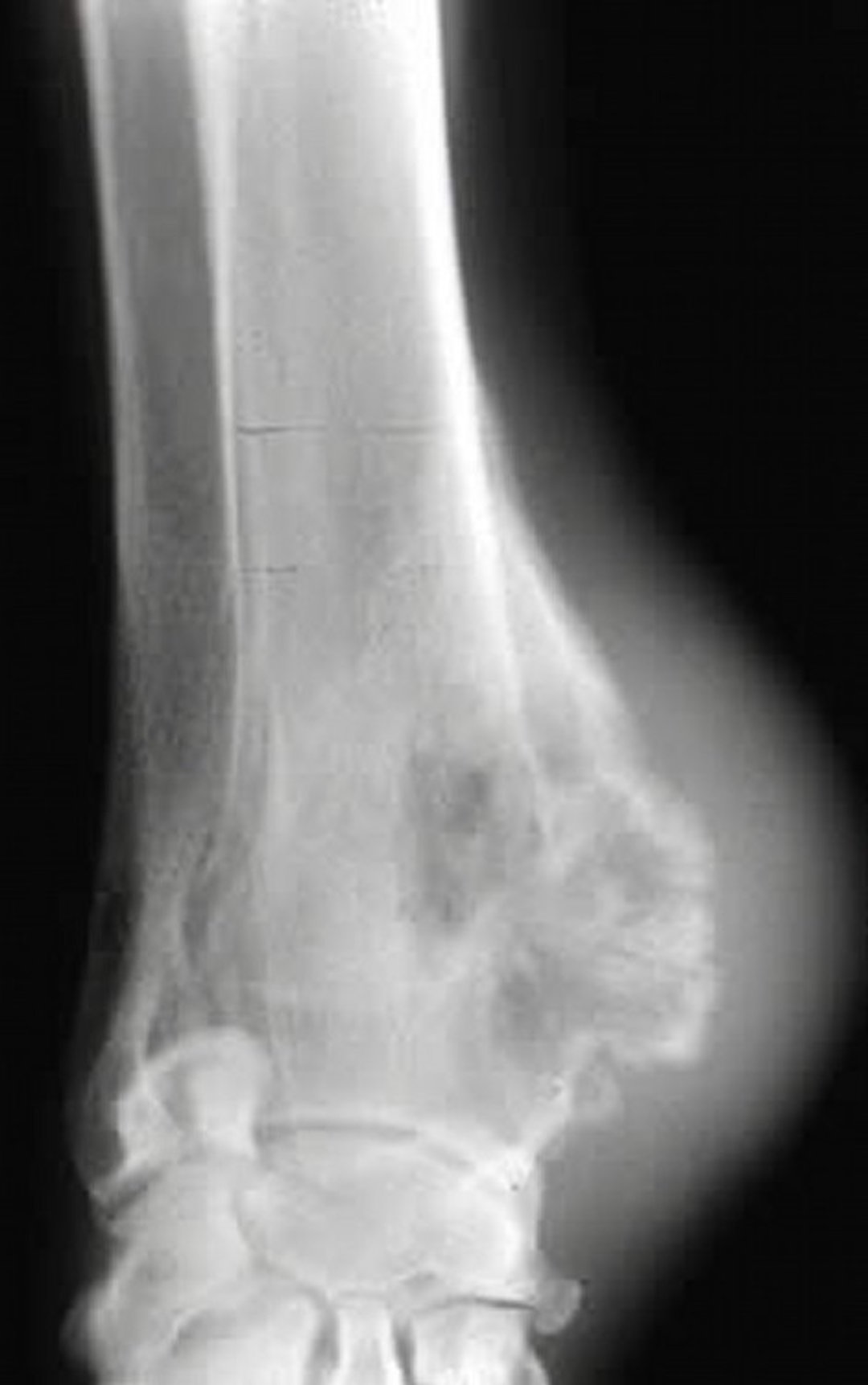 Osteossarcoma, radiografia, cão