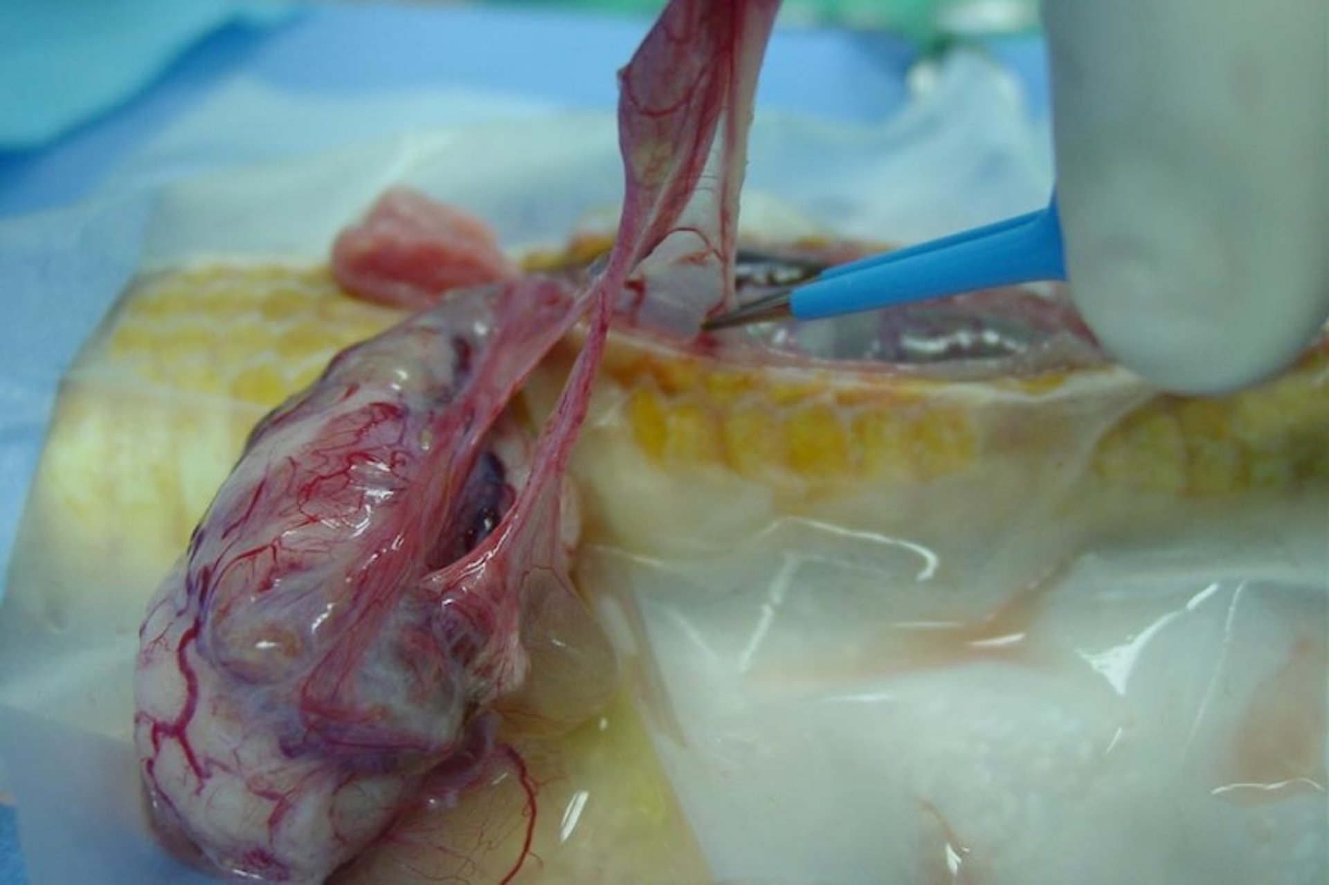 Surgical removal of ovarian granulosa cell tumor, corn snake
