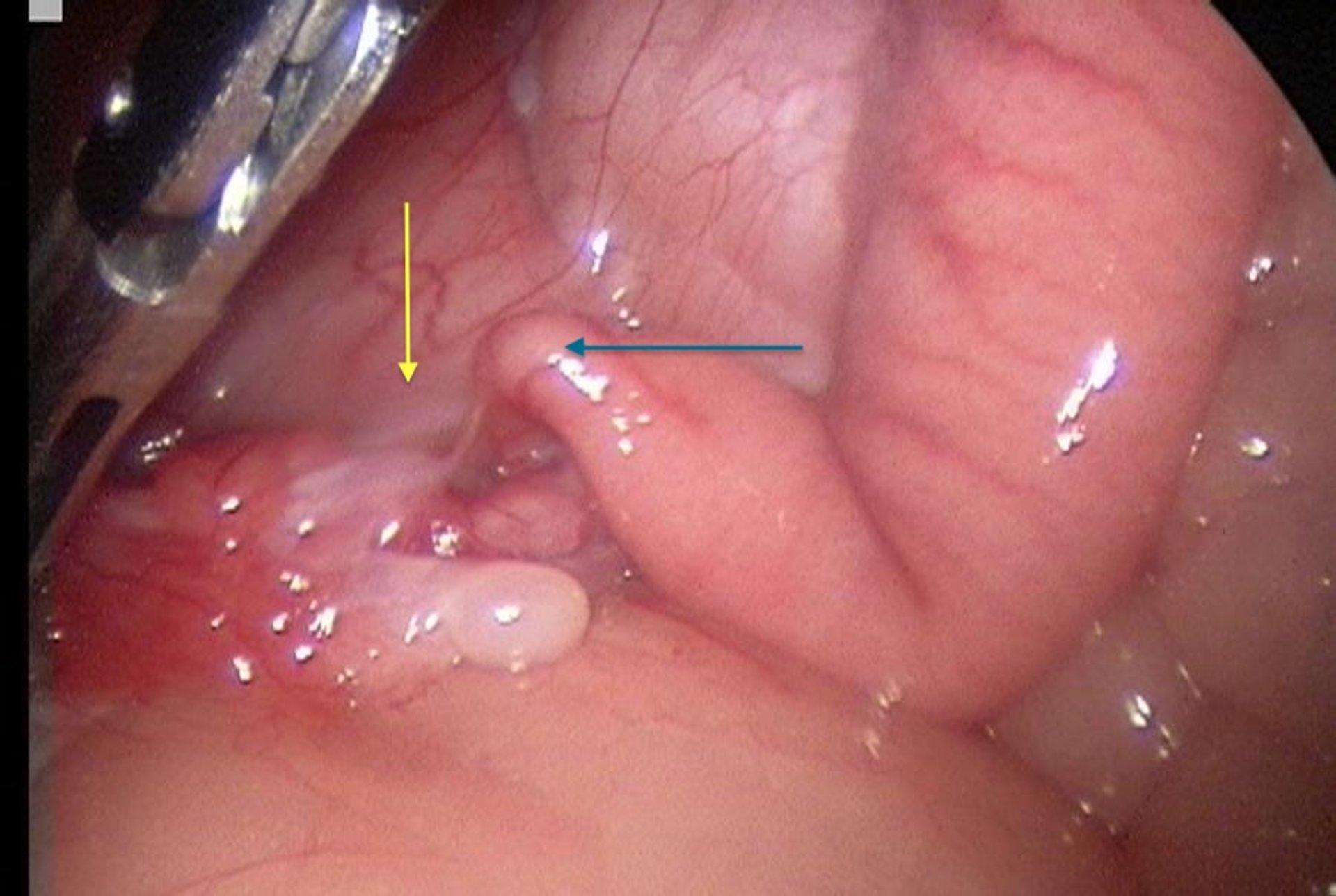 Ovarian hypoplasia, alpaca, laparoscopic image