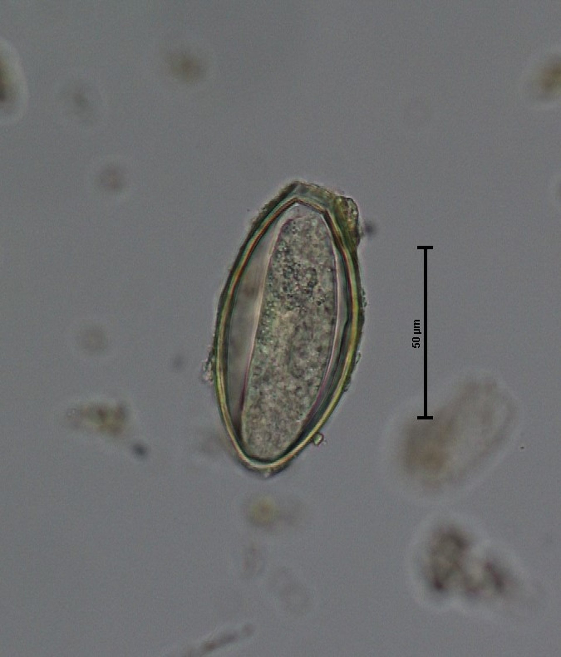 Huevo de <i >Oxyuris equi</i>