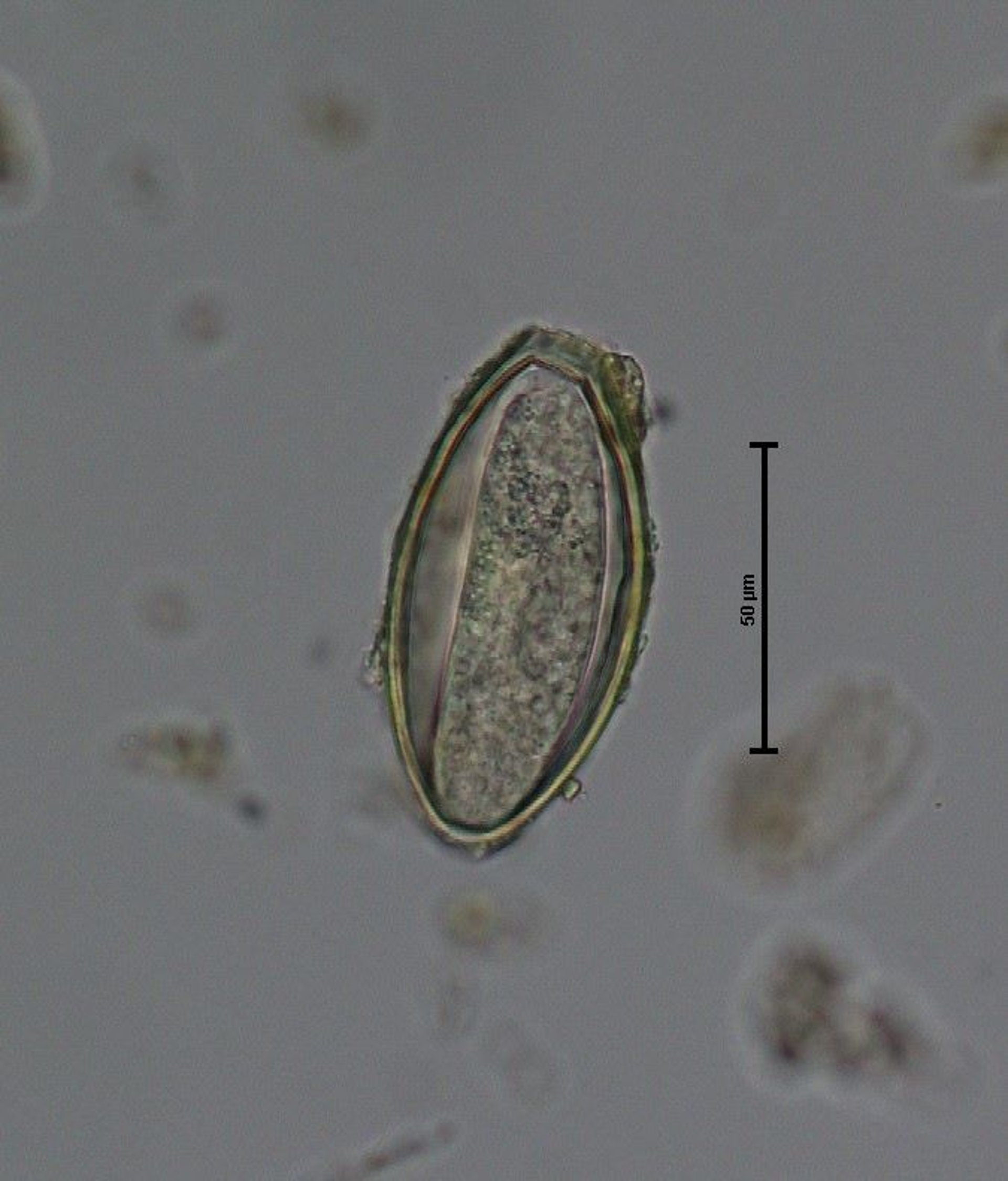 <i >Oxyuris equi</i>, ovo