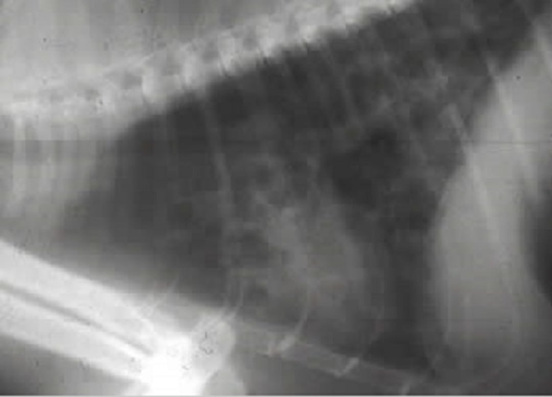 <i >Paragonimus</i> spp, (lung flukes) thoracic radiograph