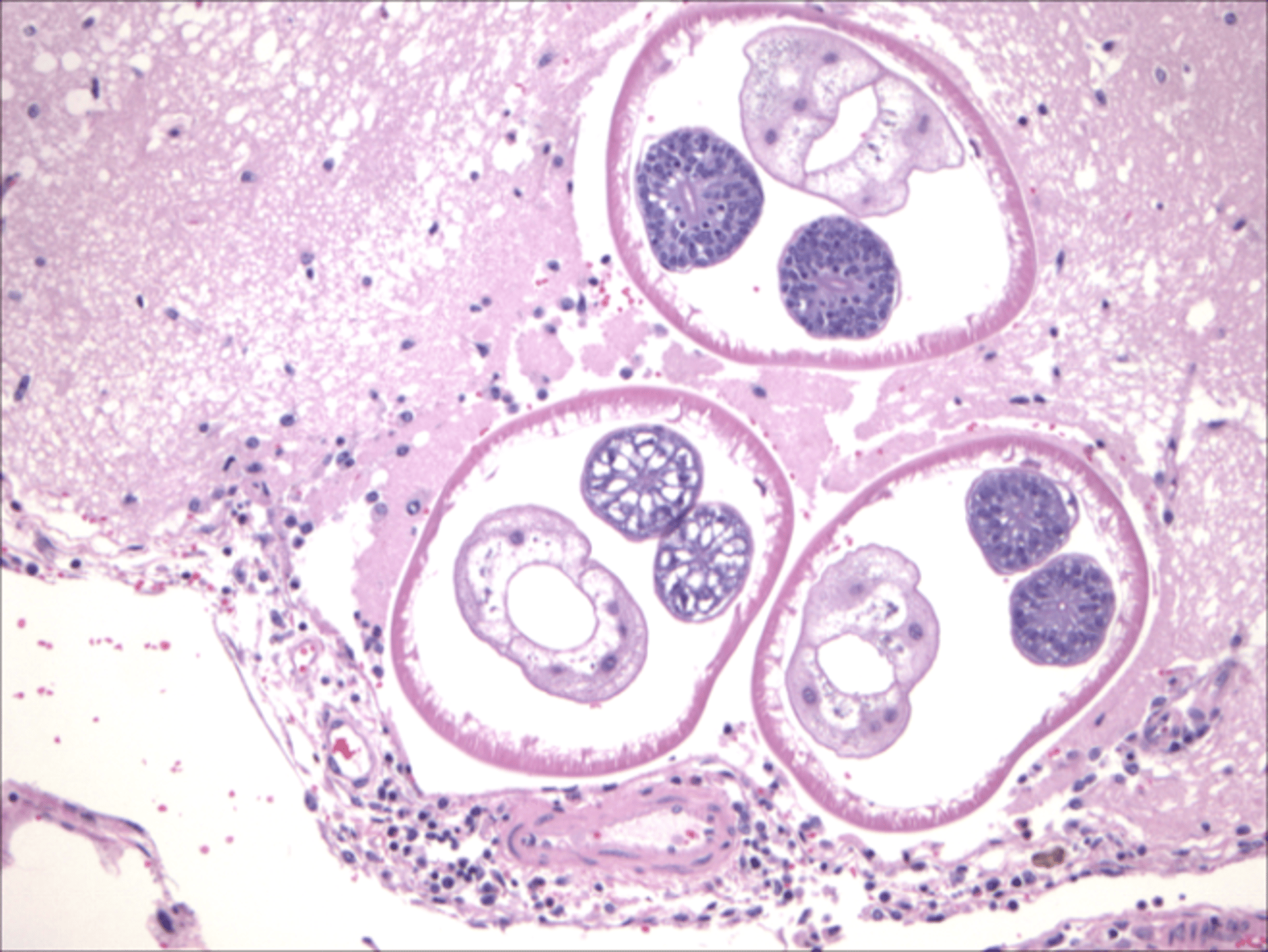 <i >Parelaphostrongylus tenuis</i>, cerebro, ciervo
