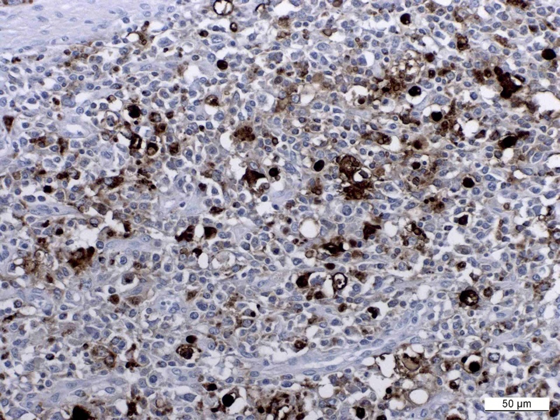 PCV-2 genome detection by in situ hybridization, pig