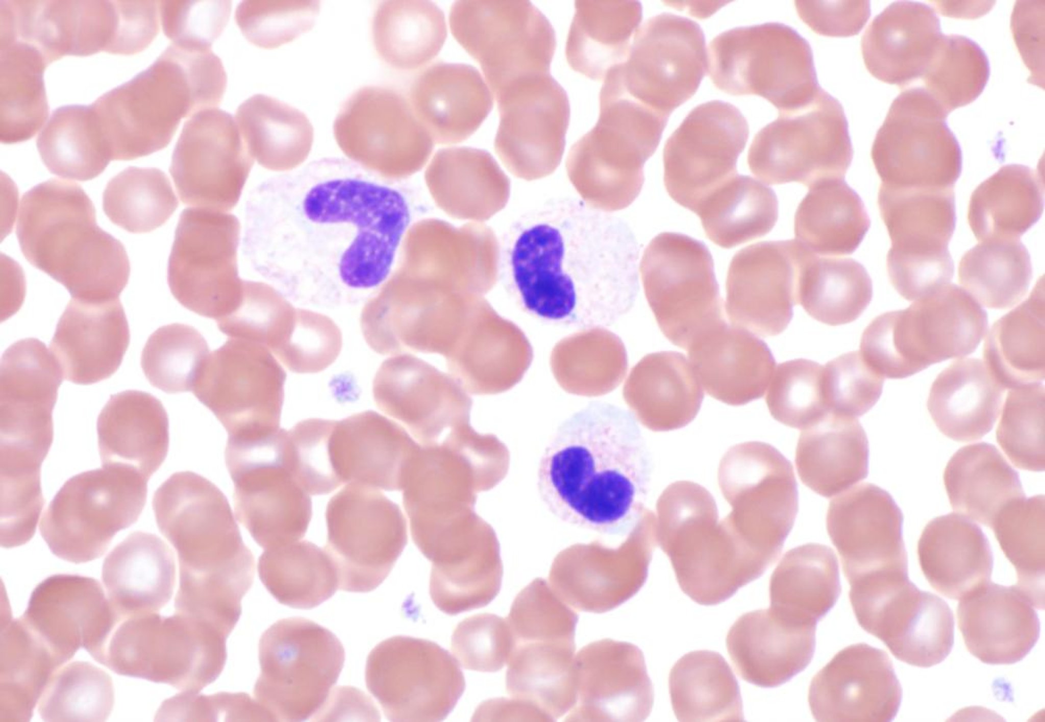Pelger-Huet anomaly, blood smear, dog