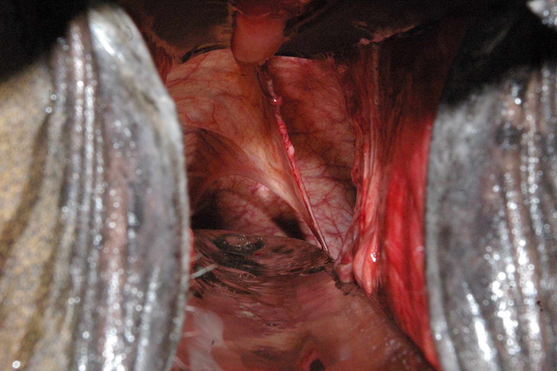 Persistent hymen and double vagina, mare