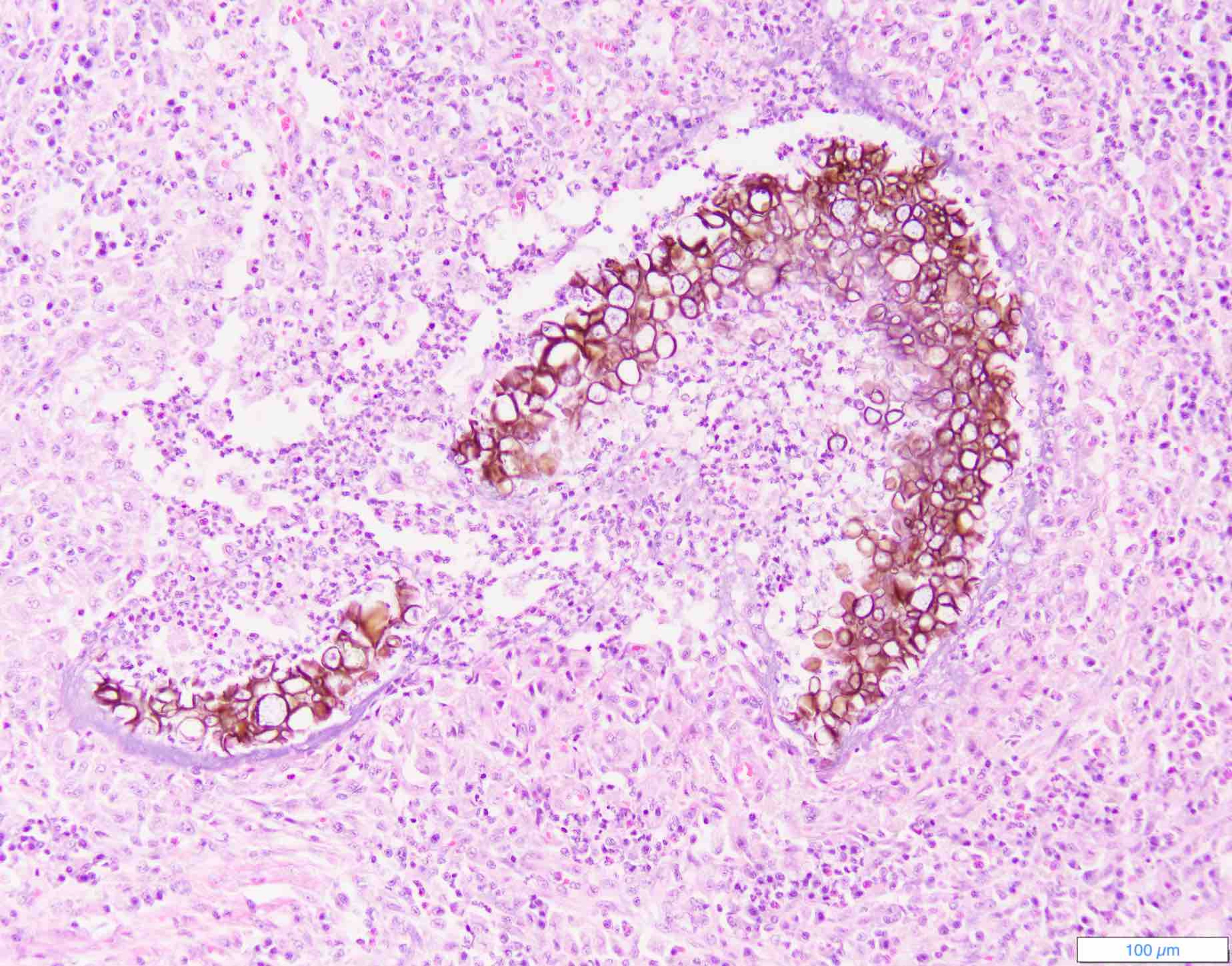 Phaeohyphomycosis, dog