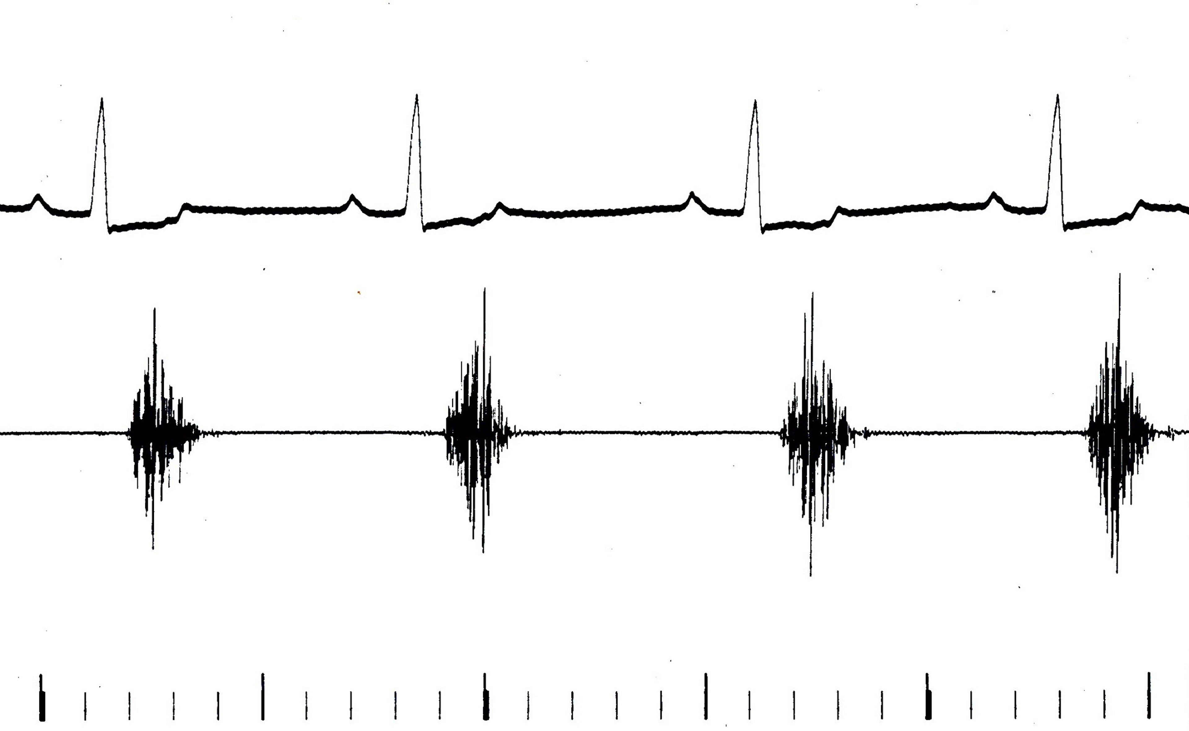 Phonocardiogram, murmur of subaortic stenosis, dog