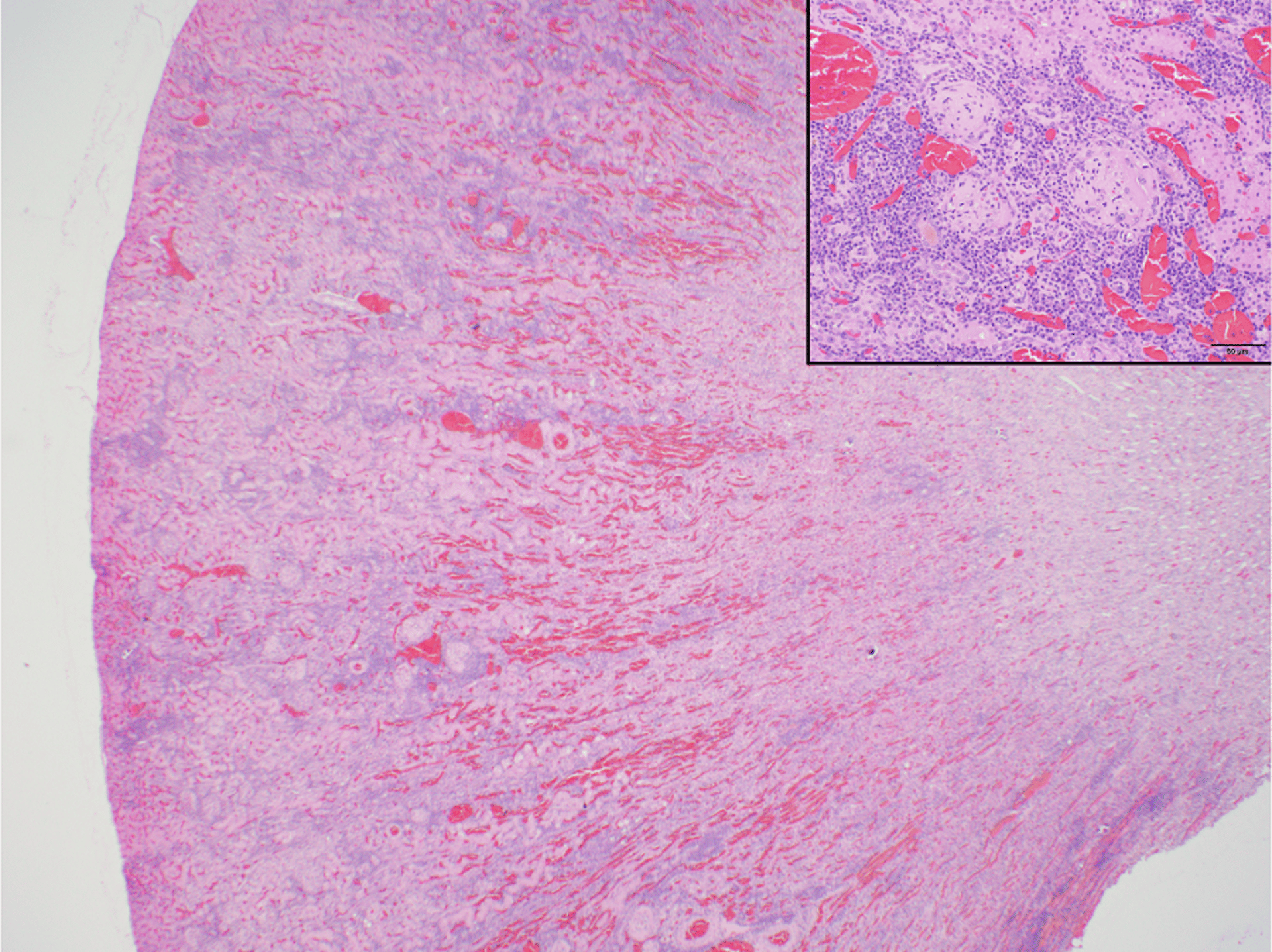 Degeneración renal crónica (microfotografía), visón