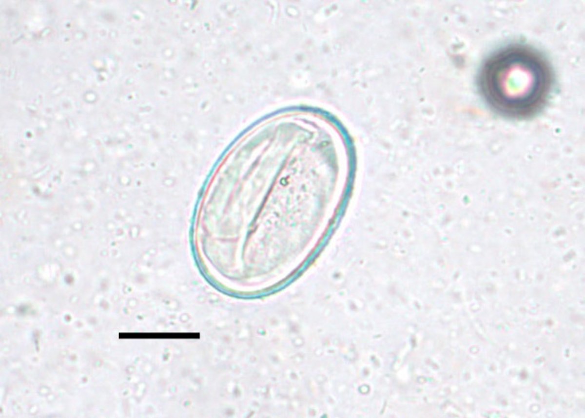 Egg,<i > Physaloptera</i> sp, dog