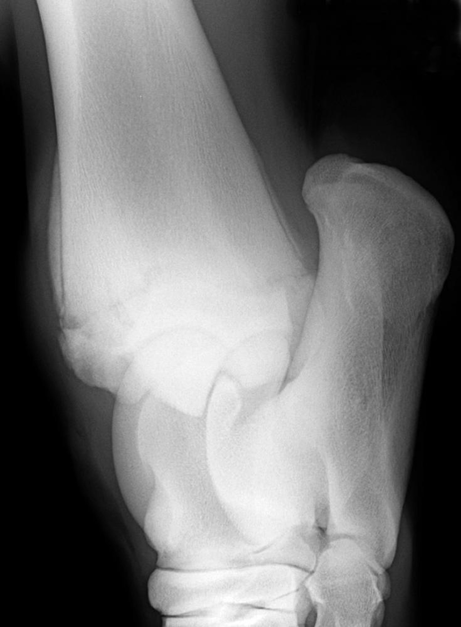Physitis, distal tibia, horse